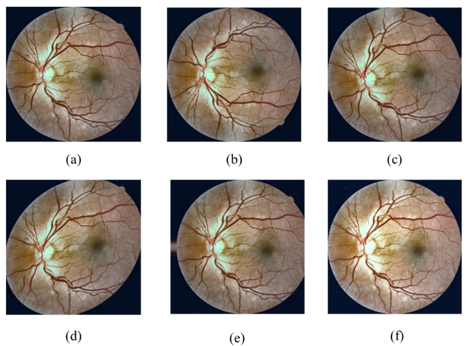 Sensors 21 03704 g008