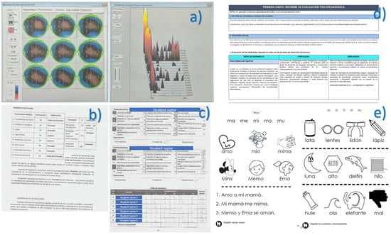Sensors 21 03787 g0a1