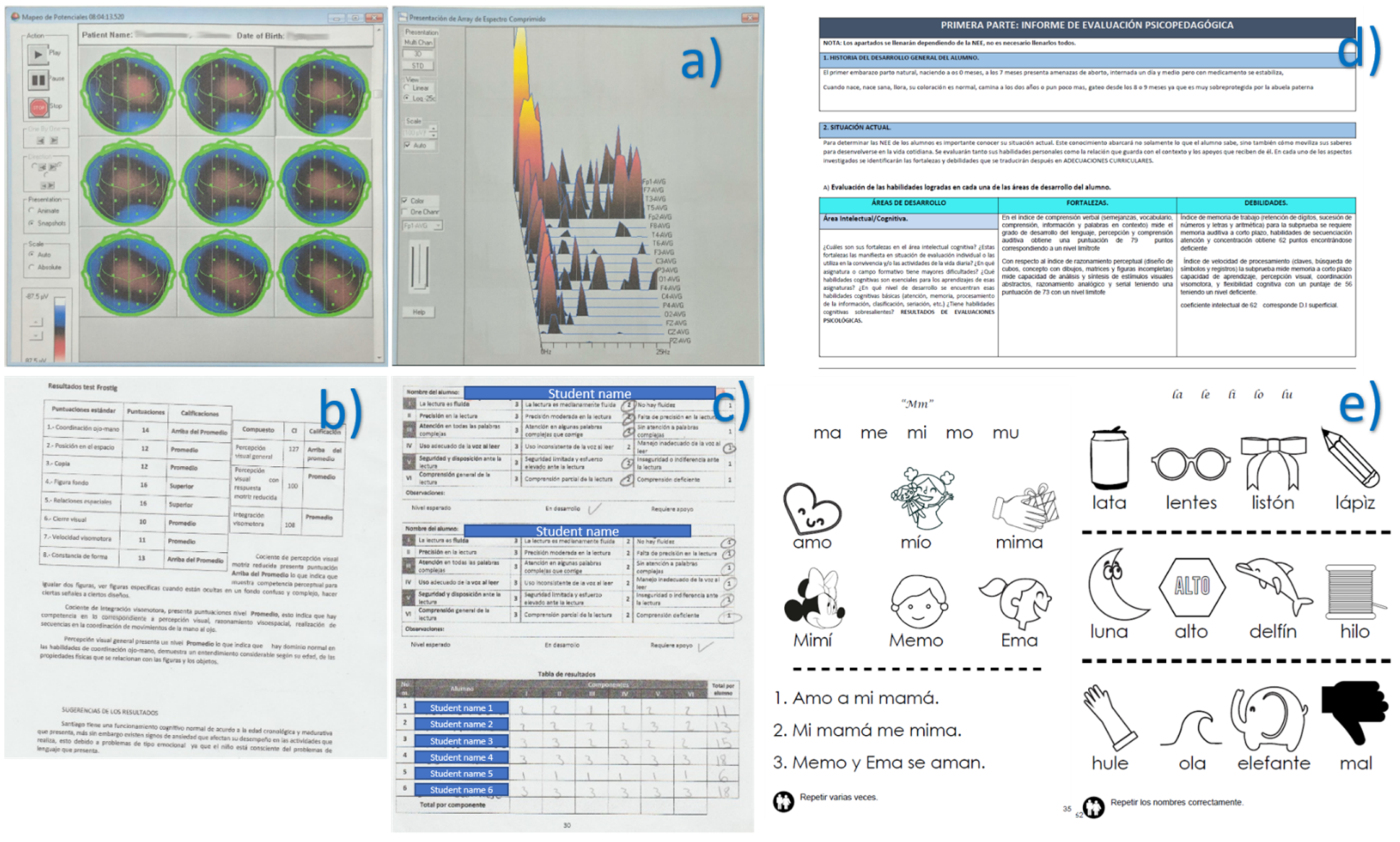 Sensors 21 03787 g0a1