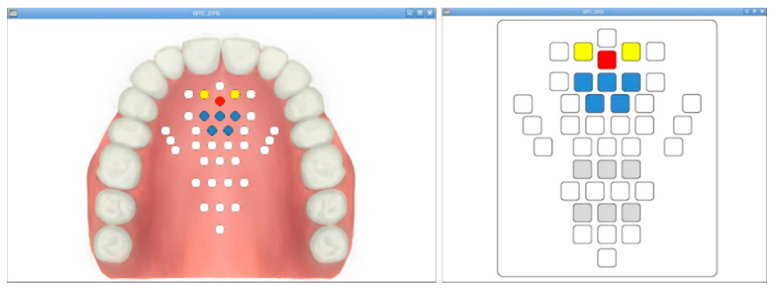 Sensors 21 03802 g005 Sensors 21 03802 g005