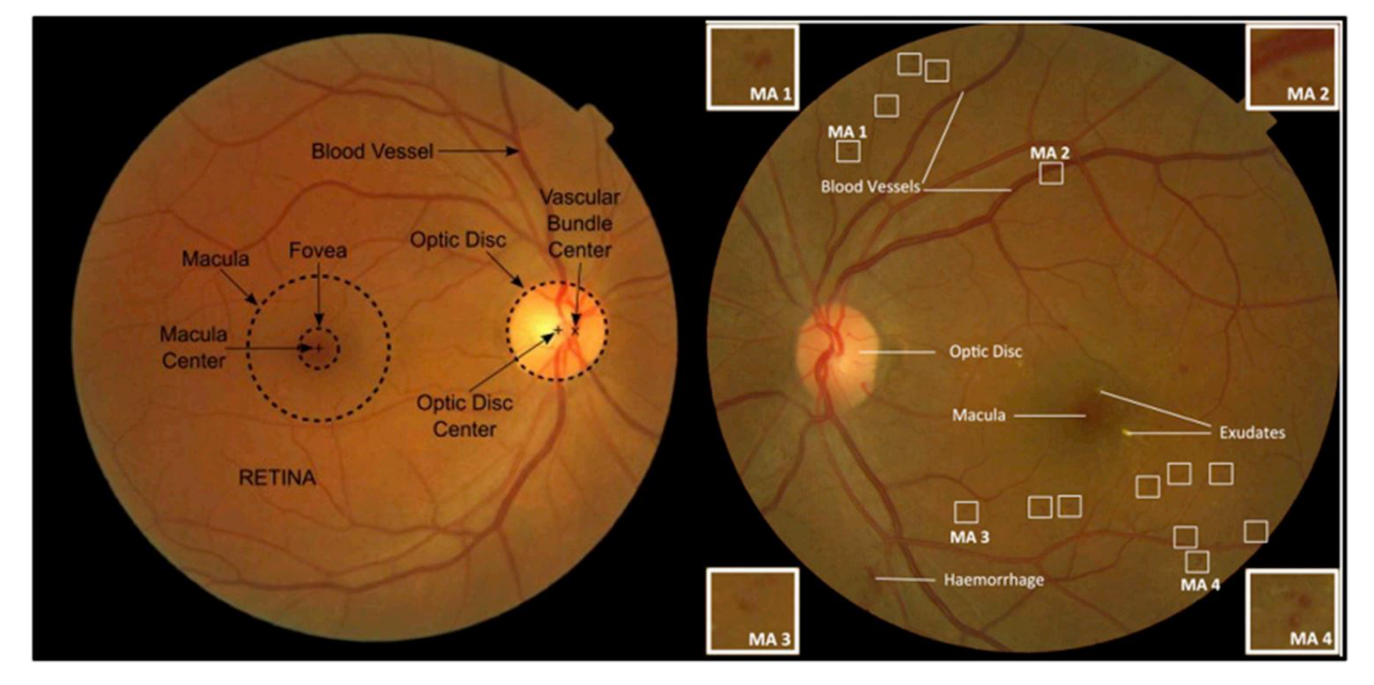 Sensors 21 03865 g001
