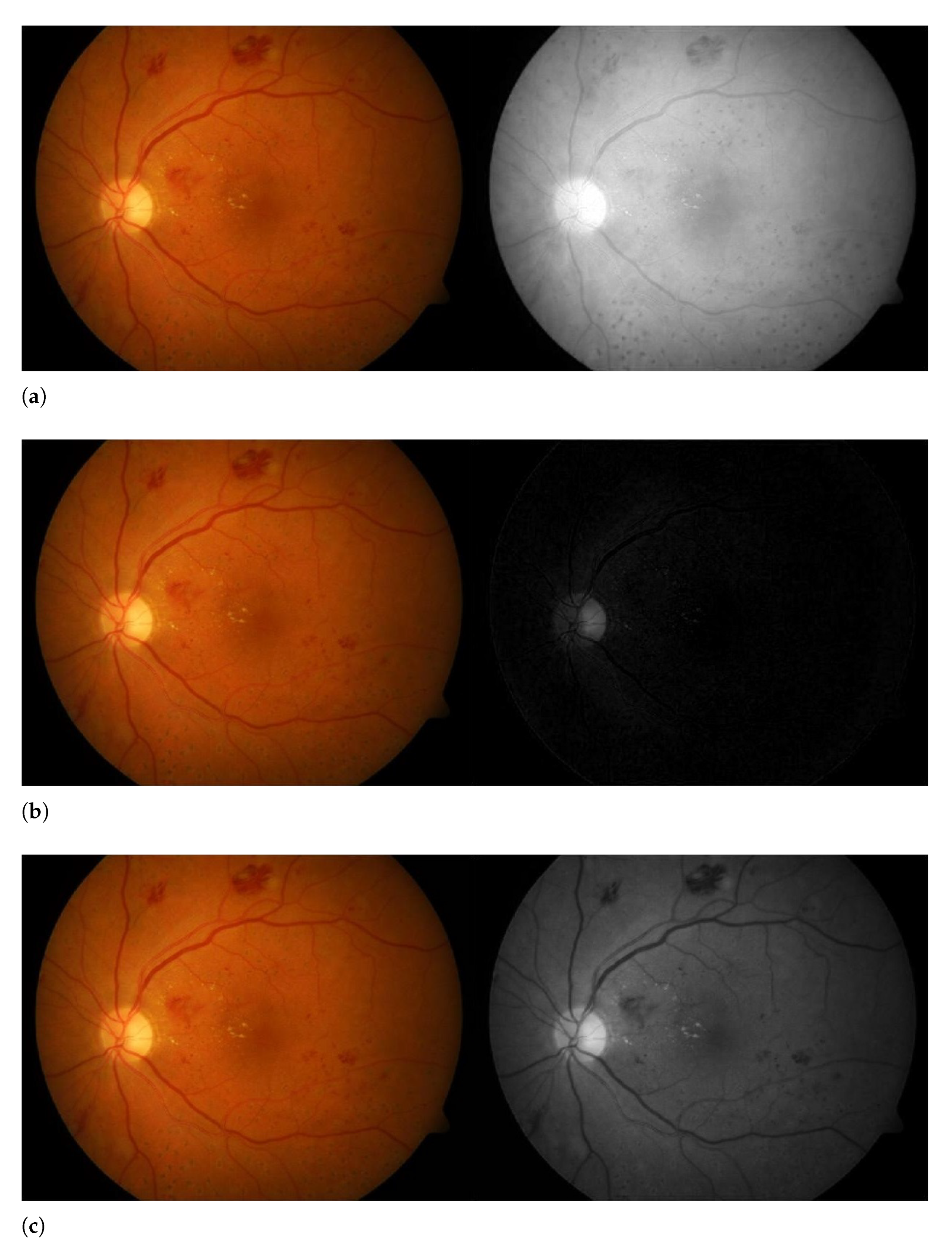 Sensors 21 03865 g003