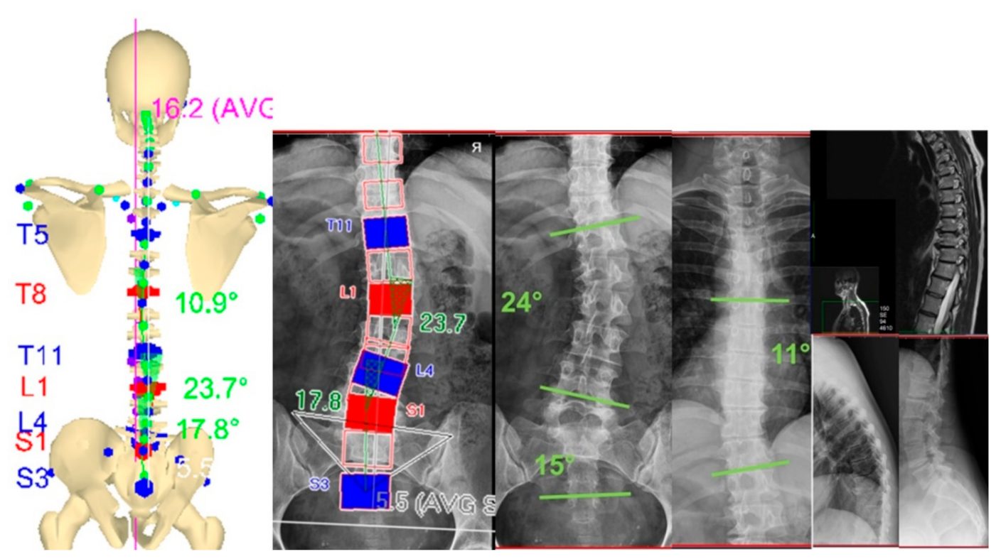 Sensors 21 03930 g003 Sensors 21 03930 g003