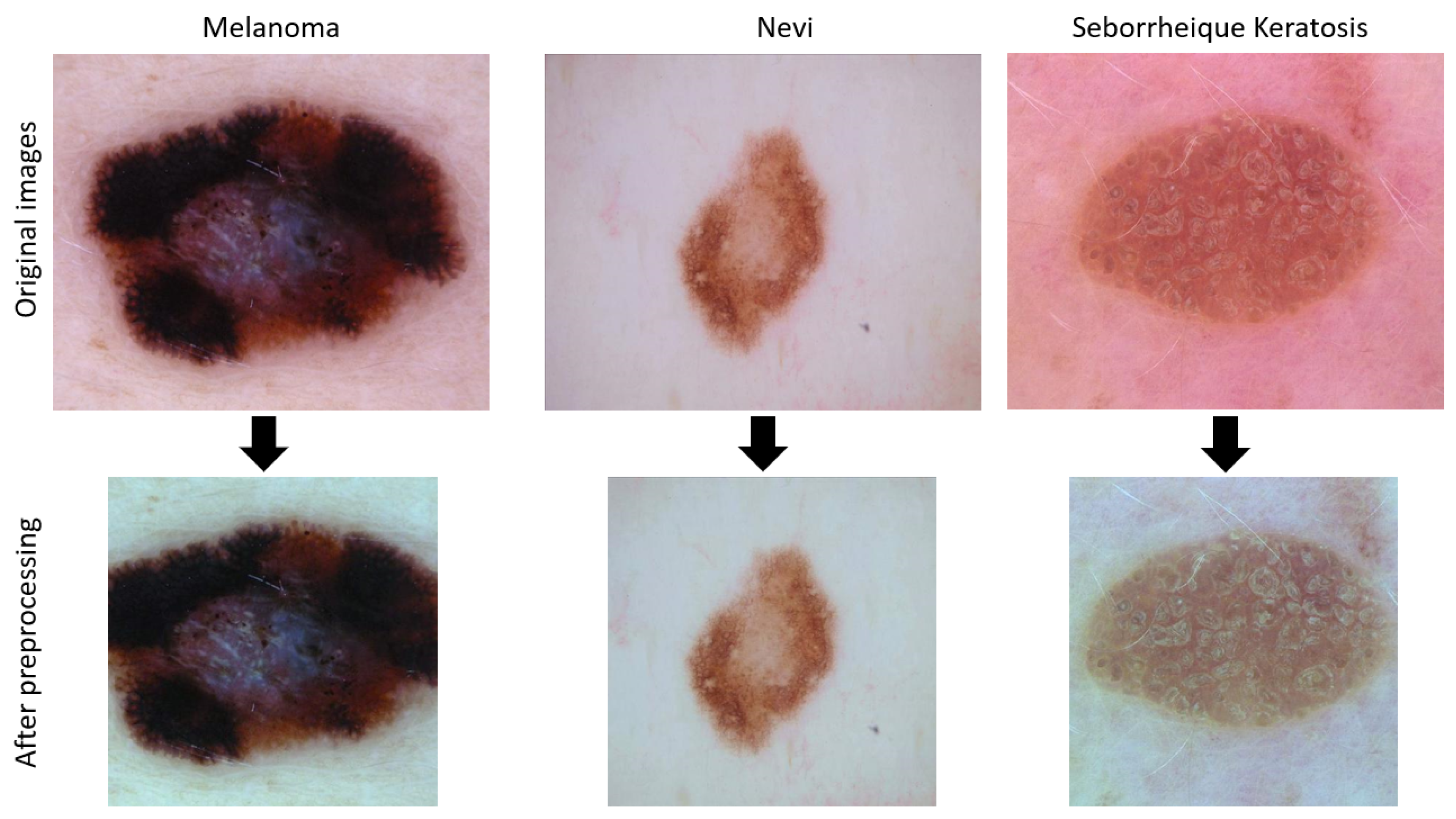 Sensors 21 03999 g004