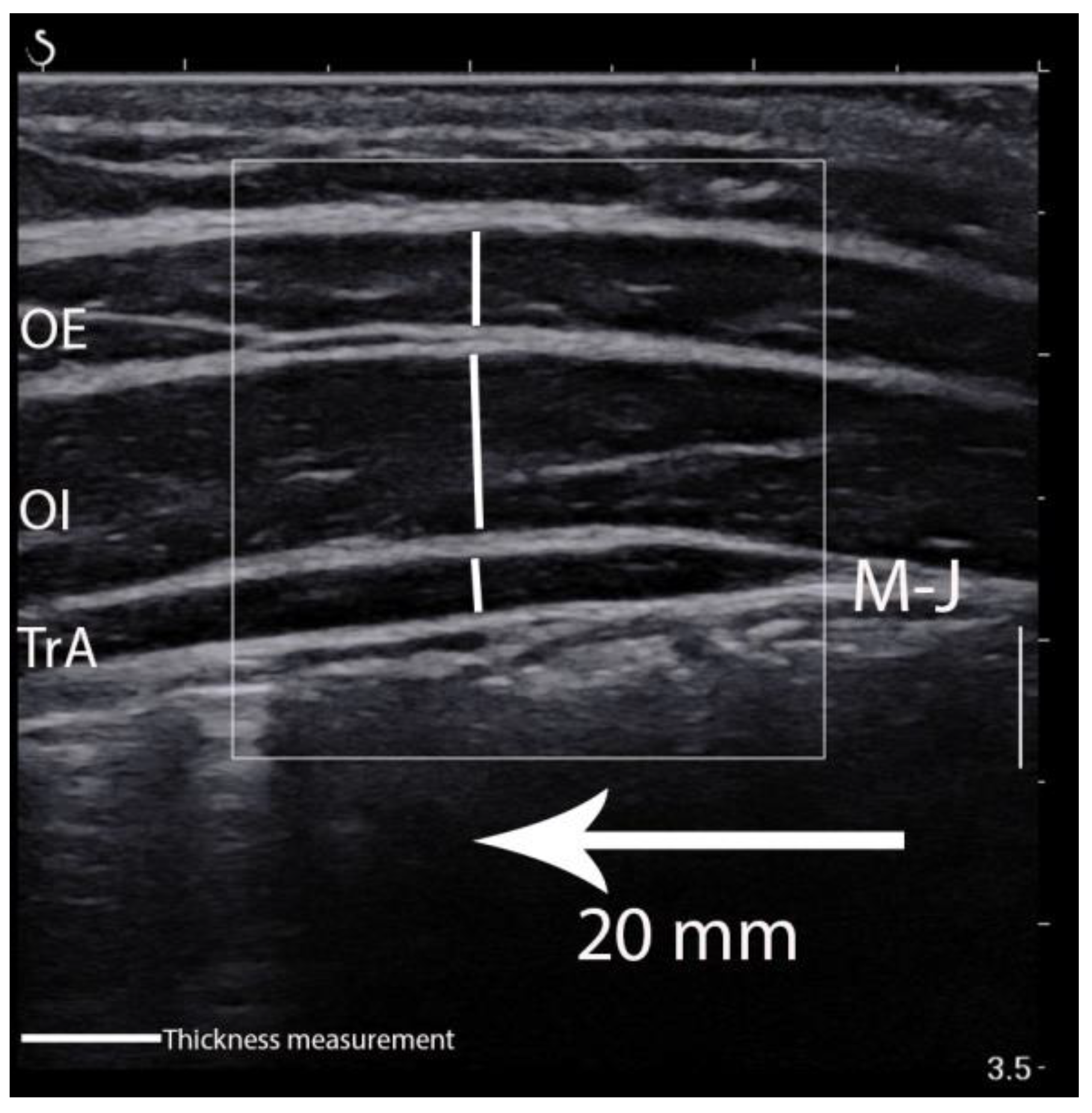 Sensors 21 04036 g003