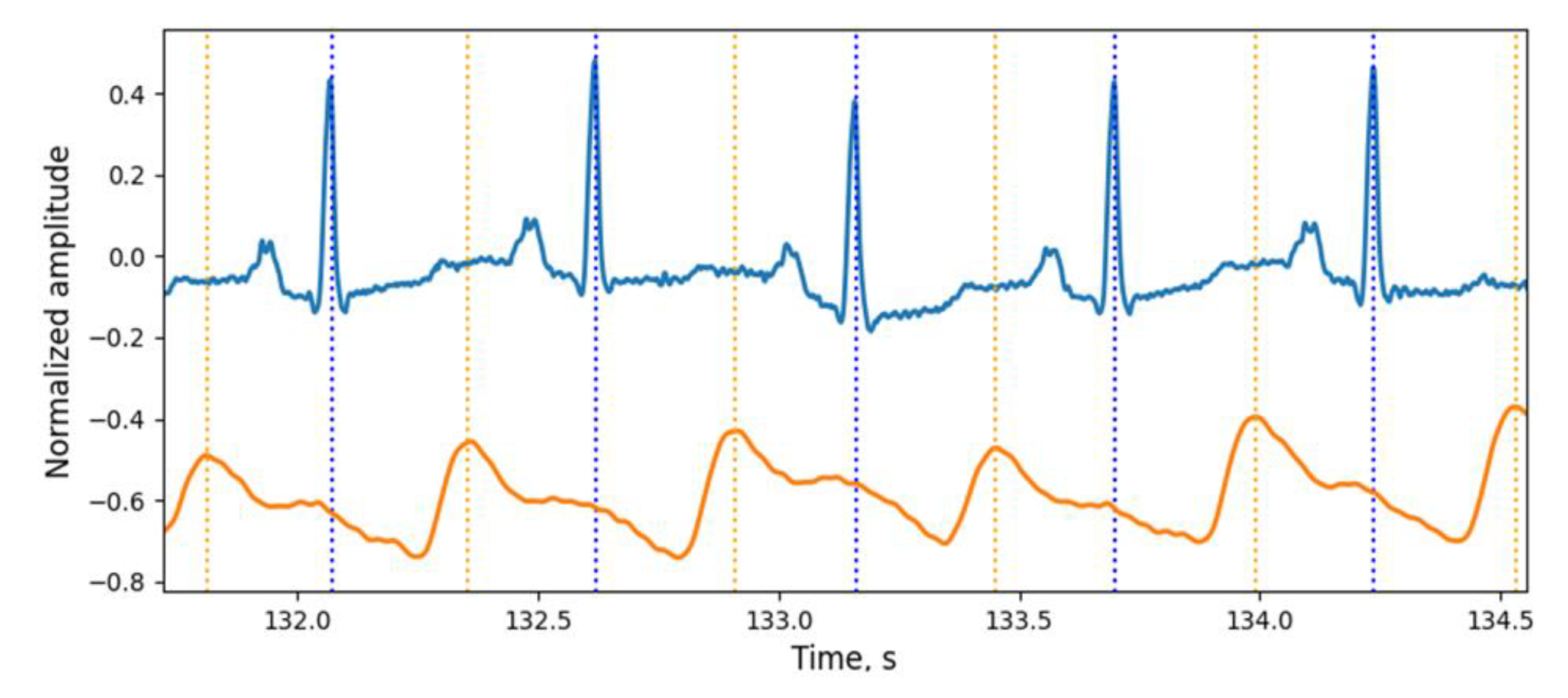 Sensors 21 04101 g011