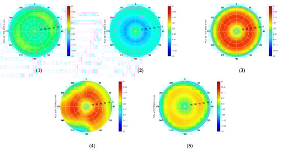 Sensors 21 04192 g0a3a