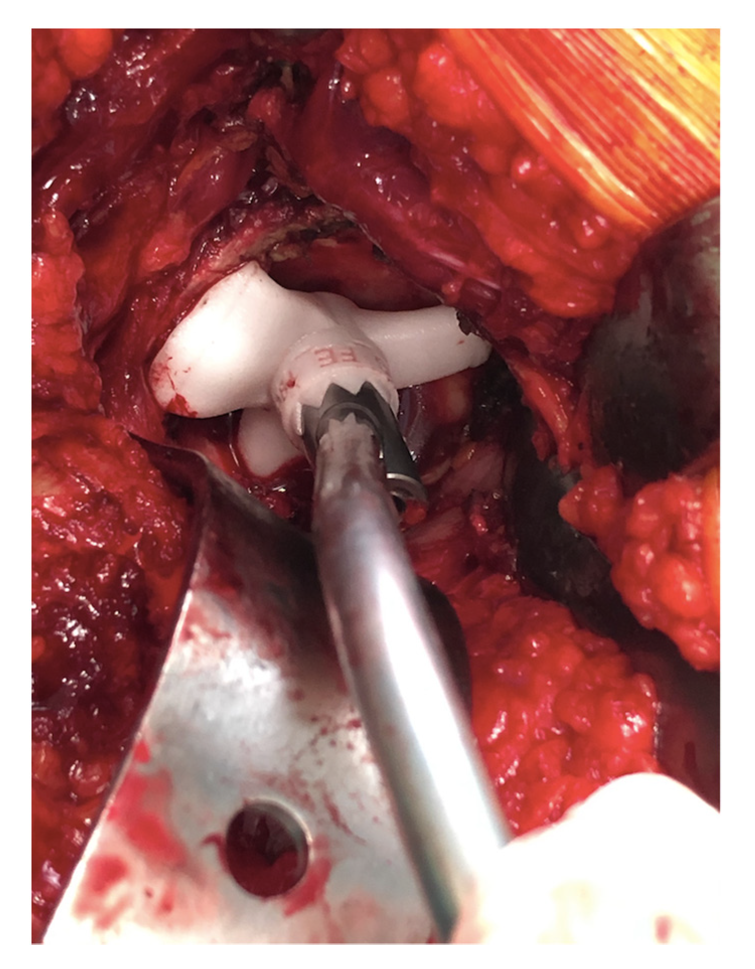 Sensors 21 04232 g004