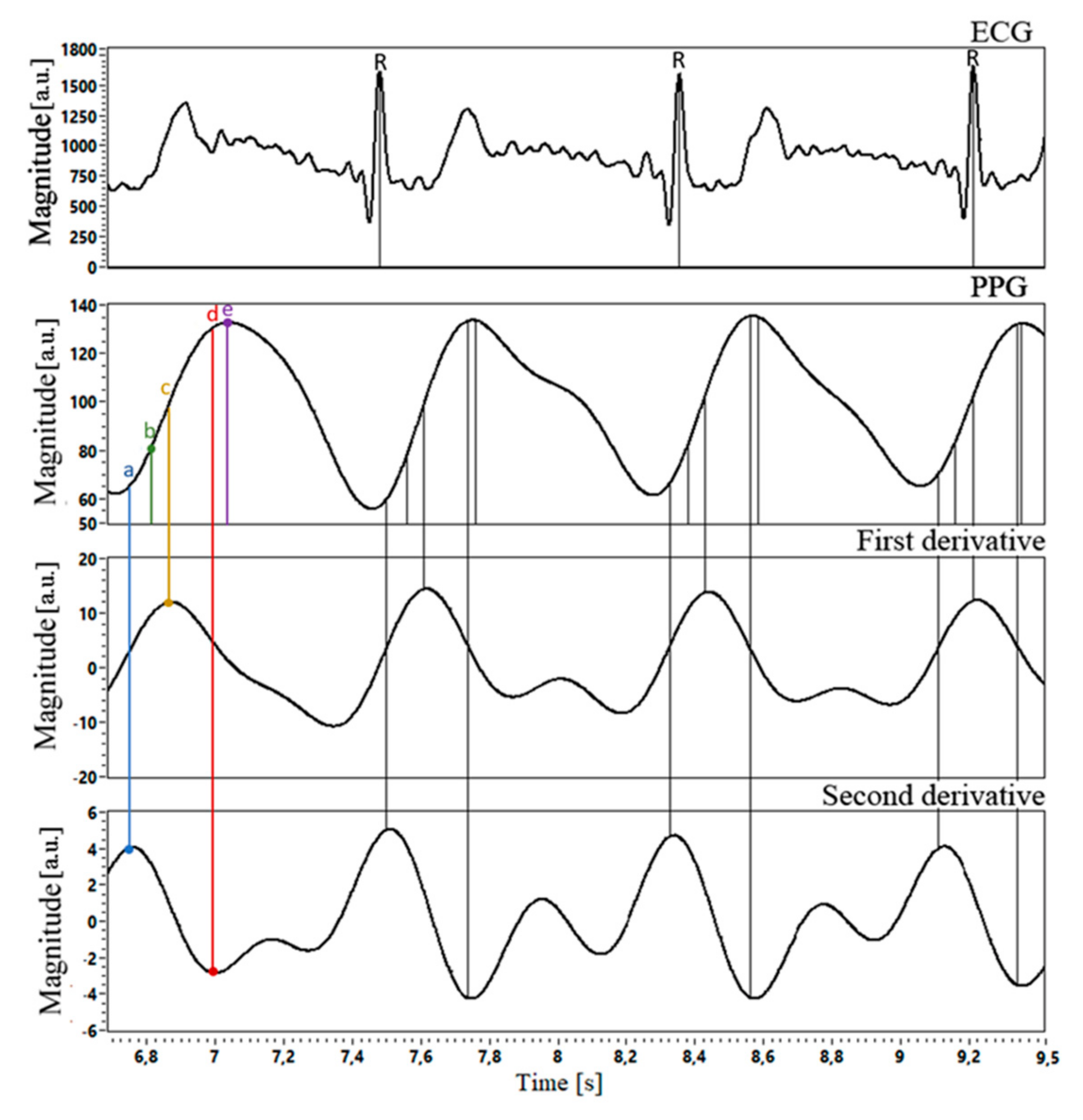 Sensors 21 04241 g005