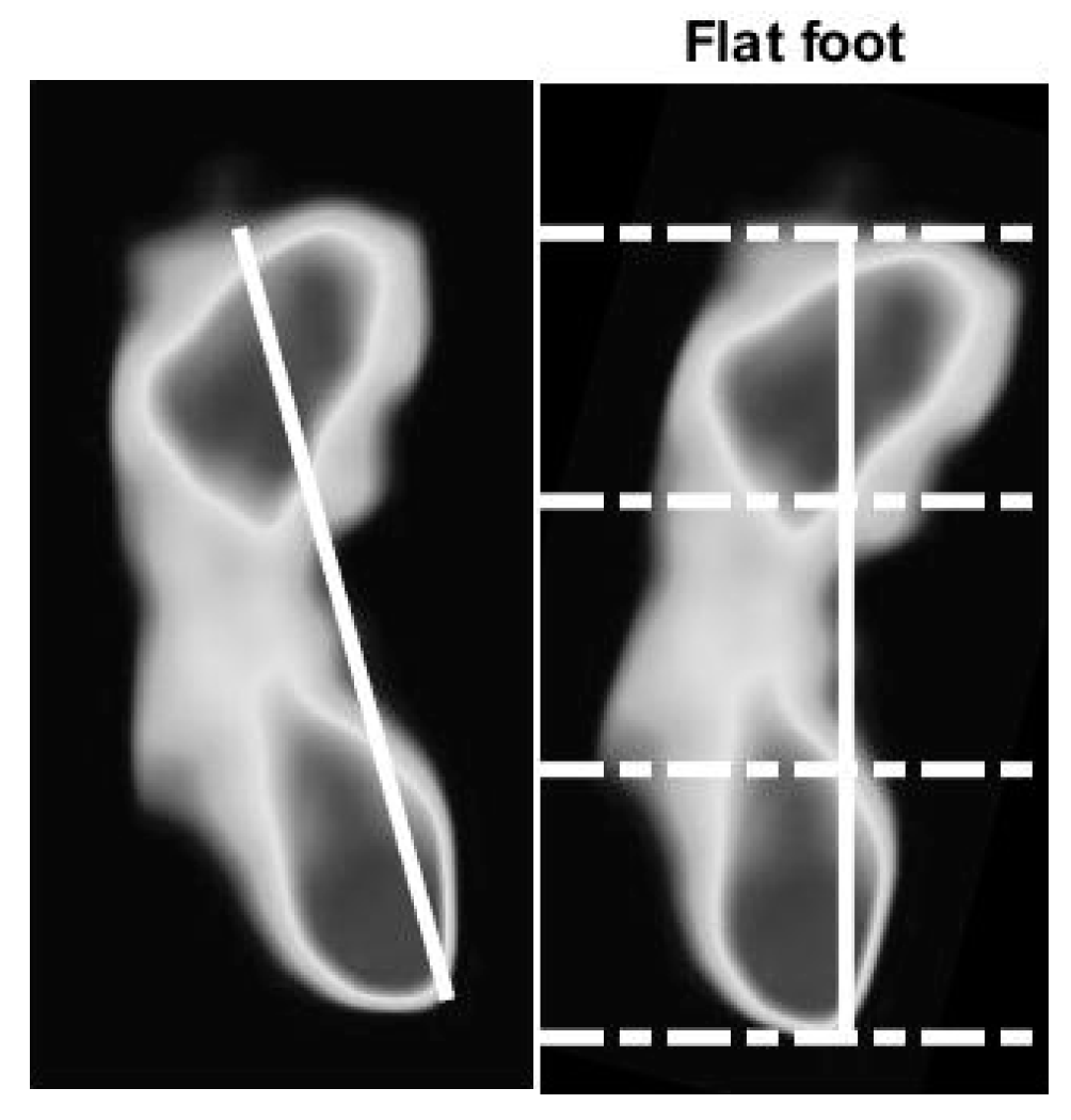 Sensors 21 04437 g011