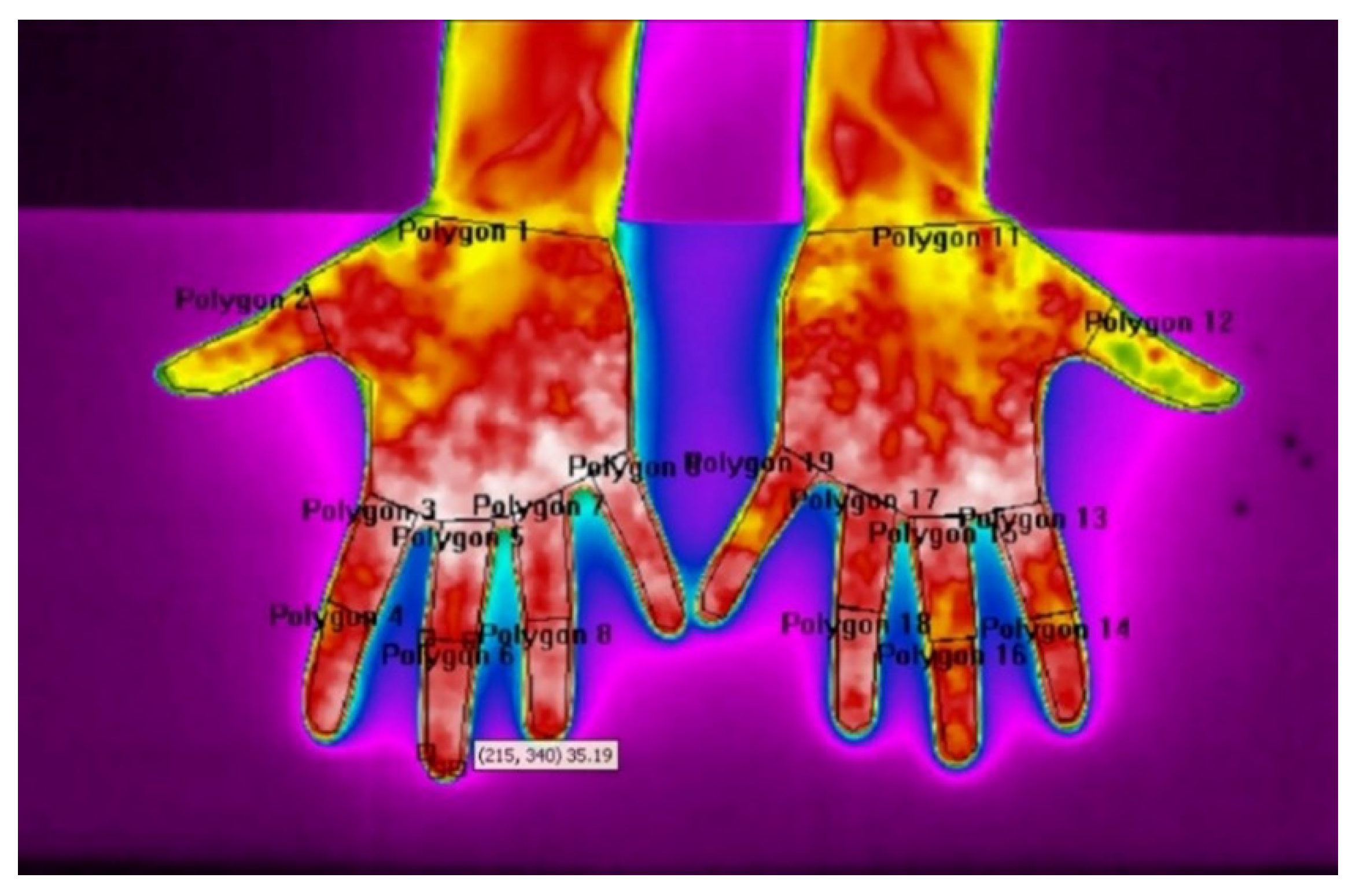 Sensors 21 04497 g003