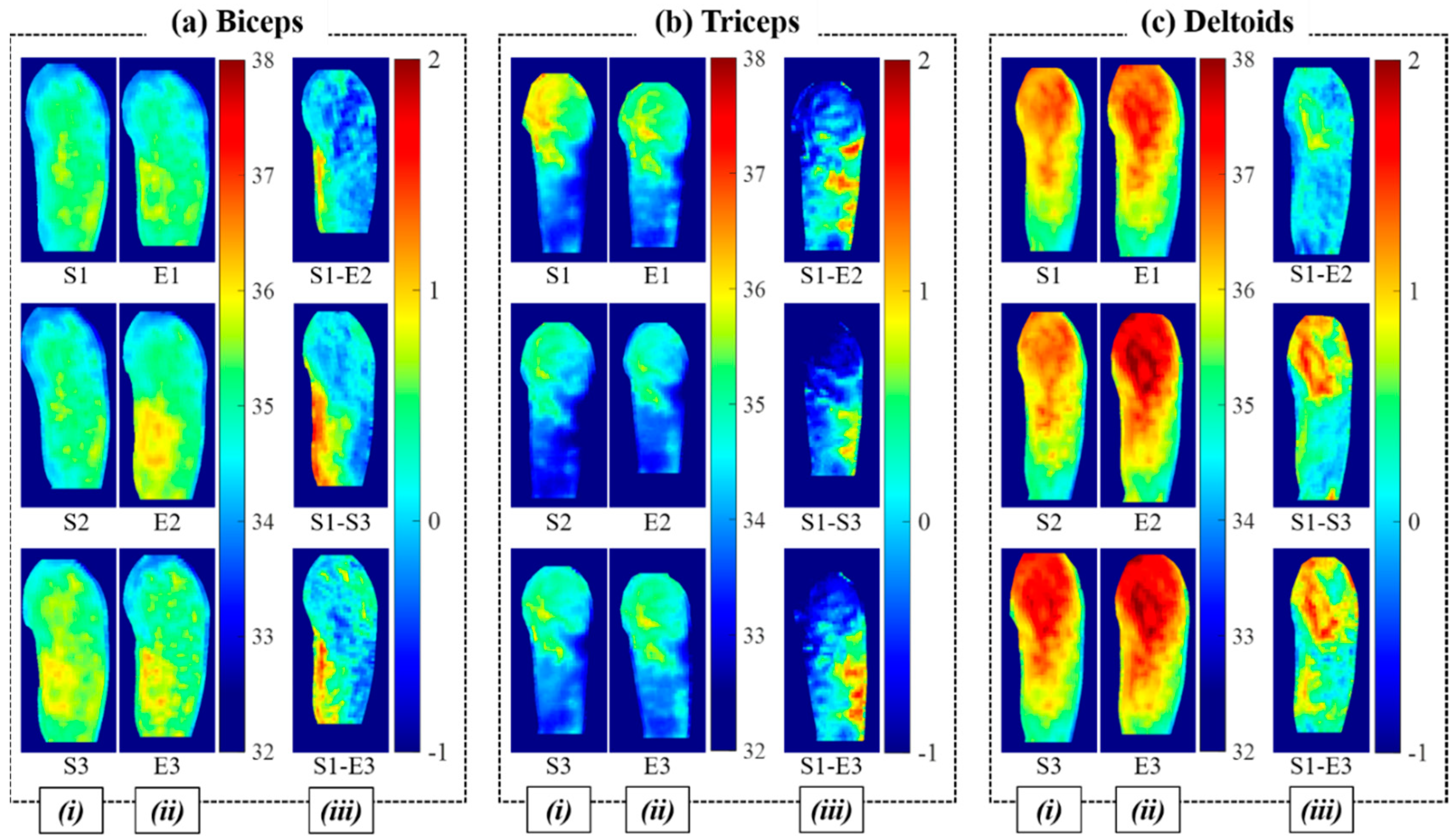 Sensors 21 04505 g004