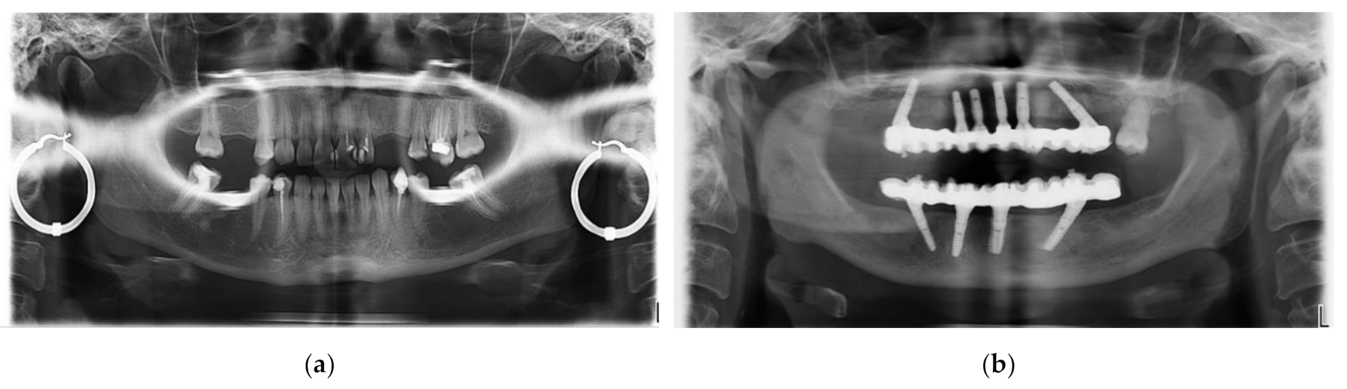 Sensors 21 04554 g017