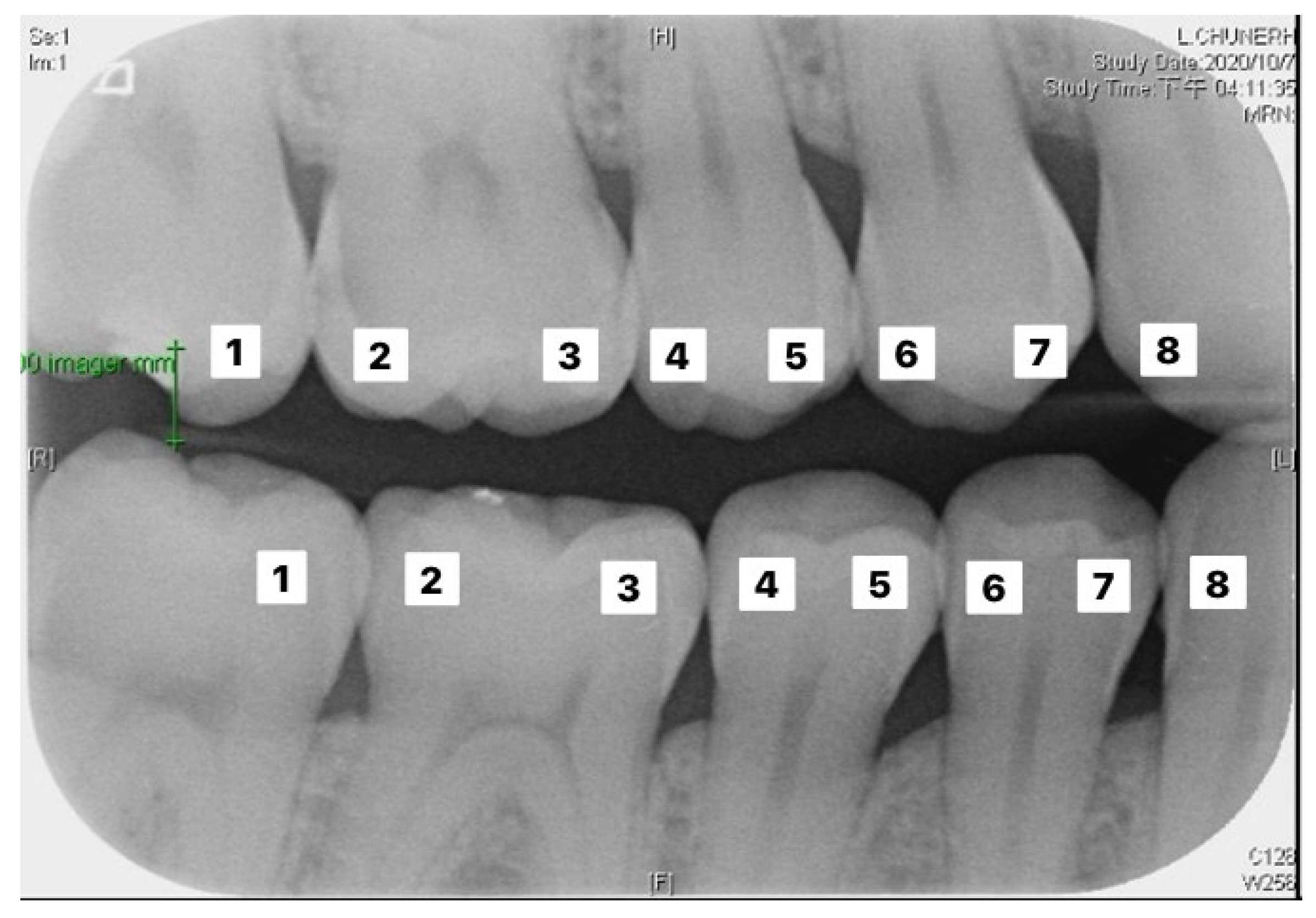 Sensors 21 04613 g009
