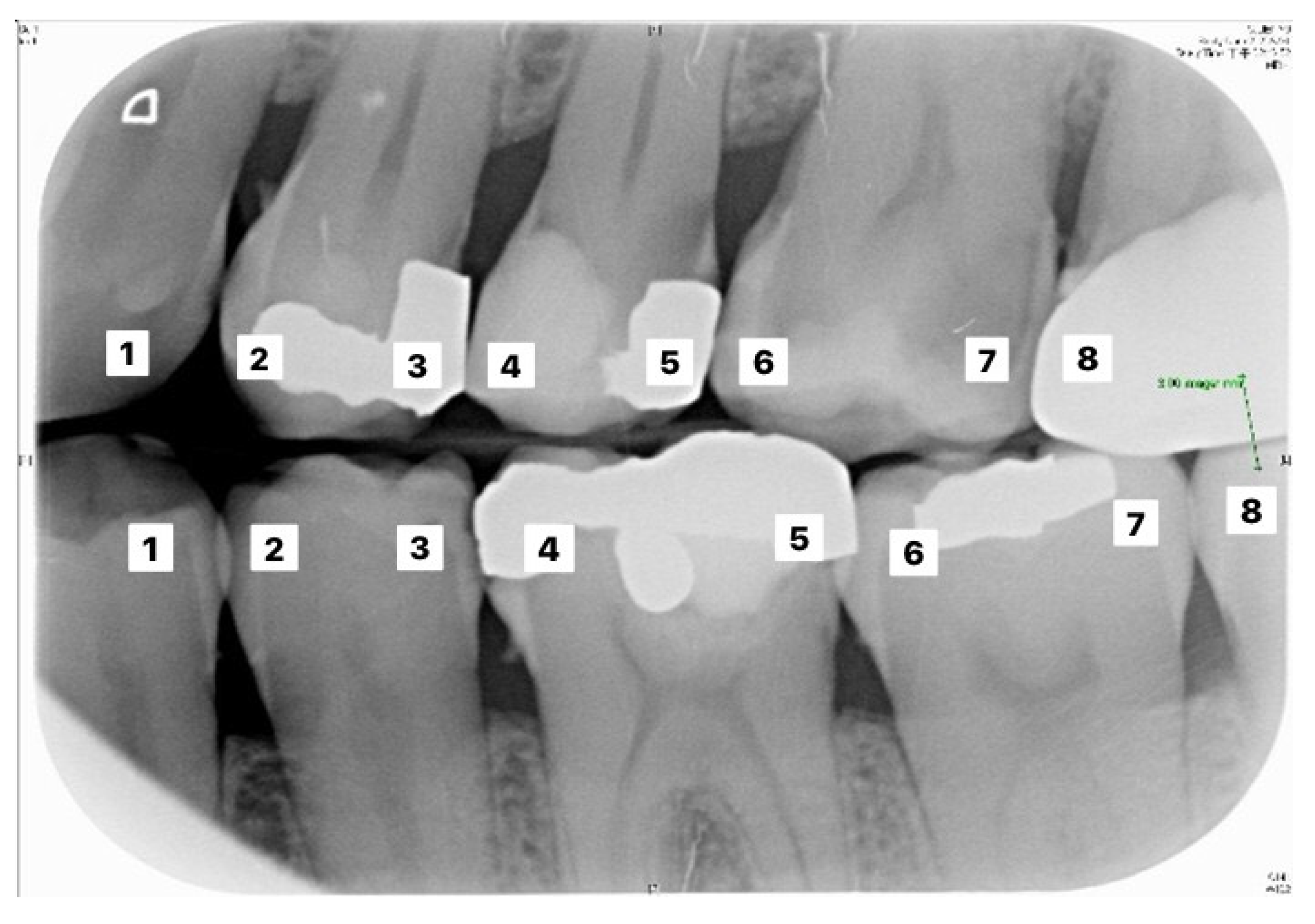 Sensors 21 04613 g010