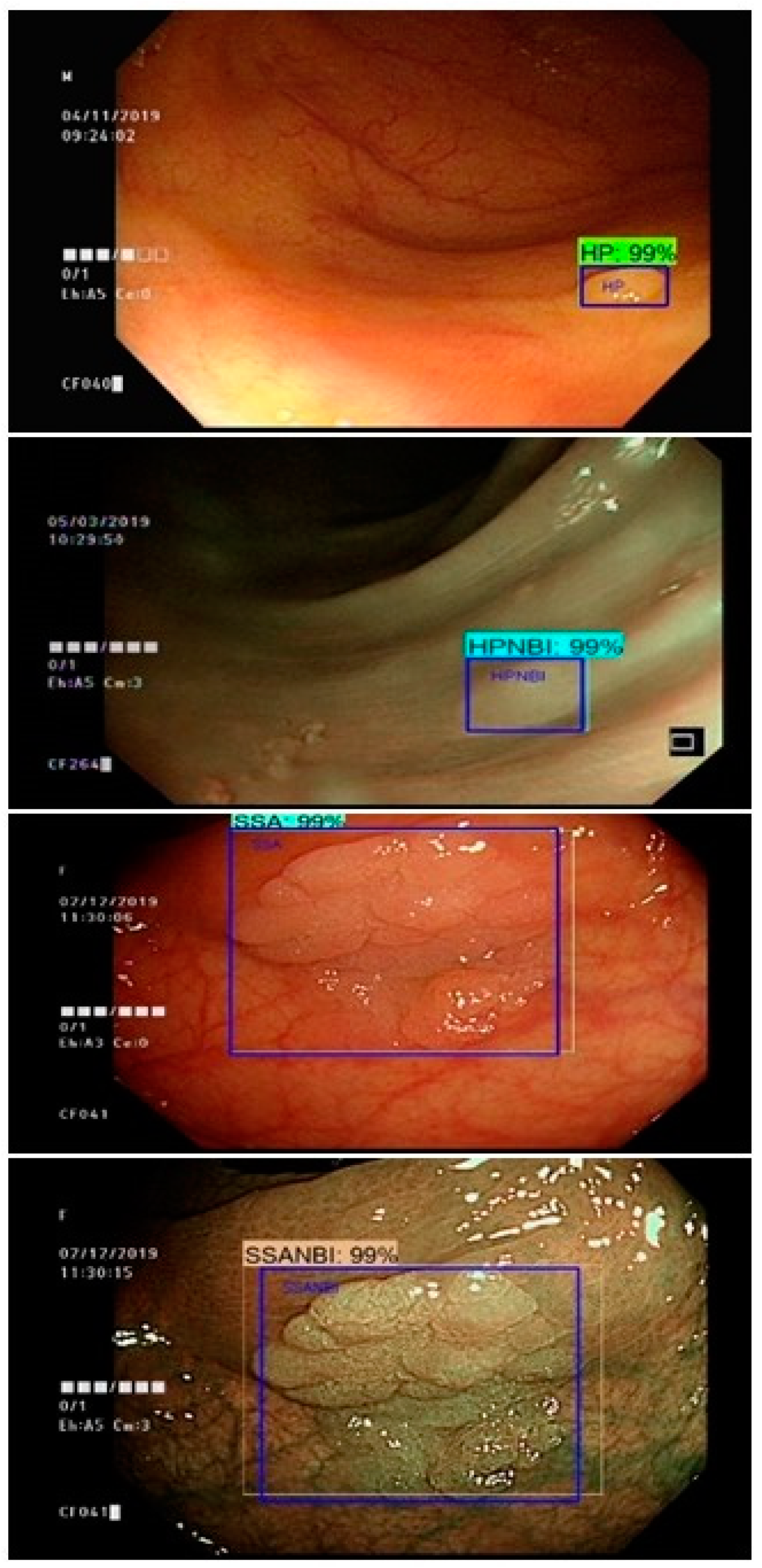 Sensors 21 05315 g007