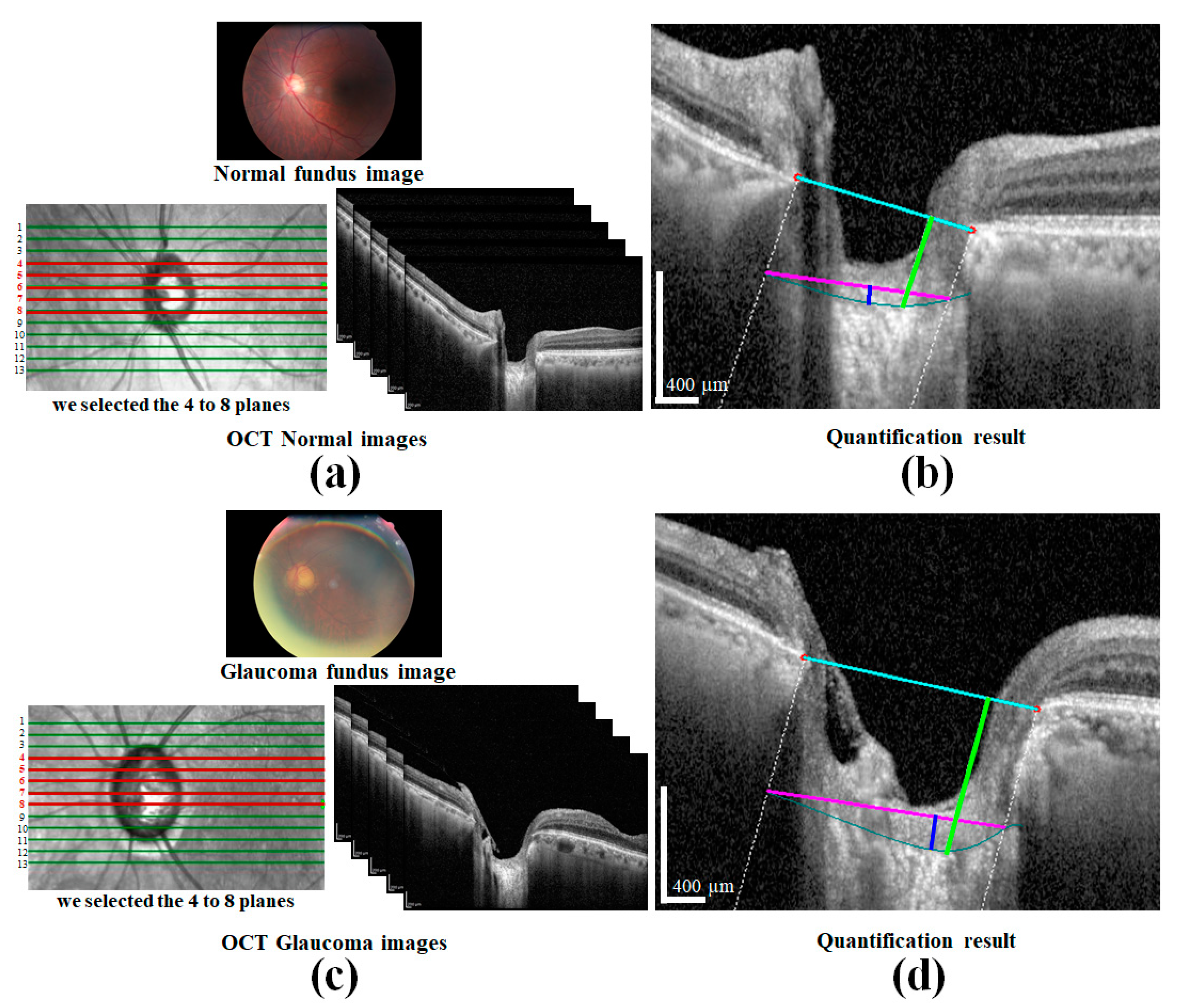 Sensors 21 05383 g013