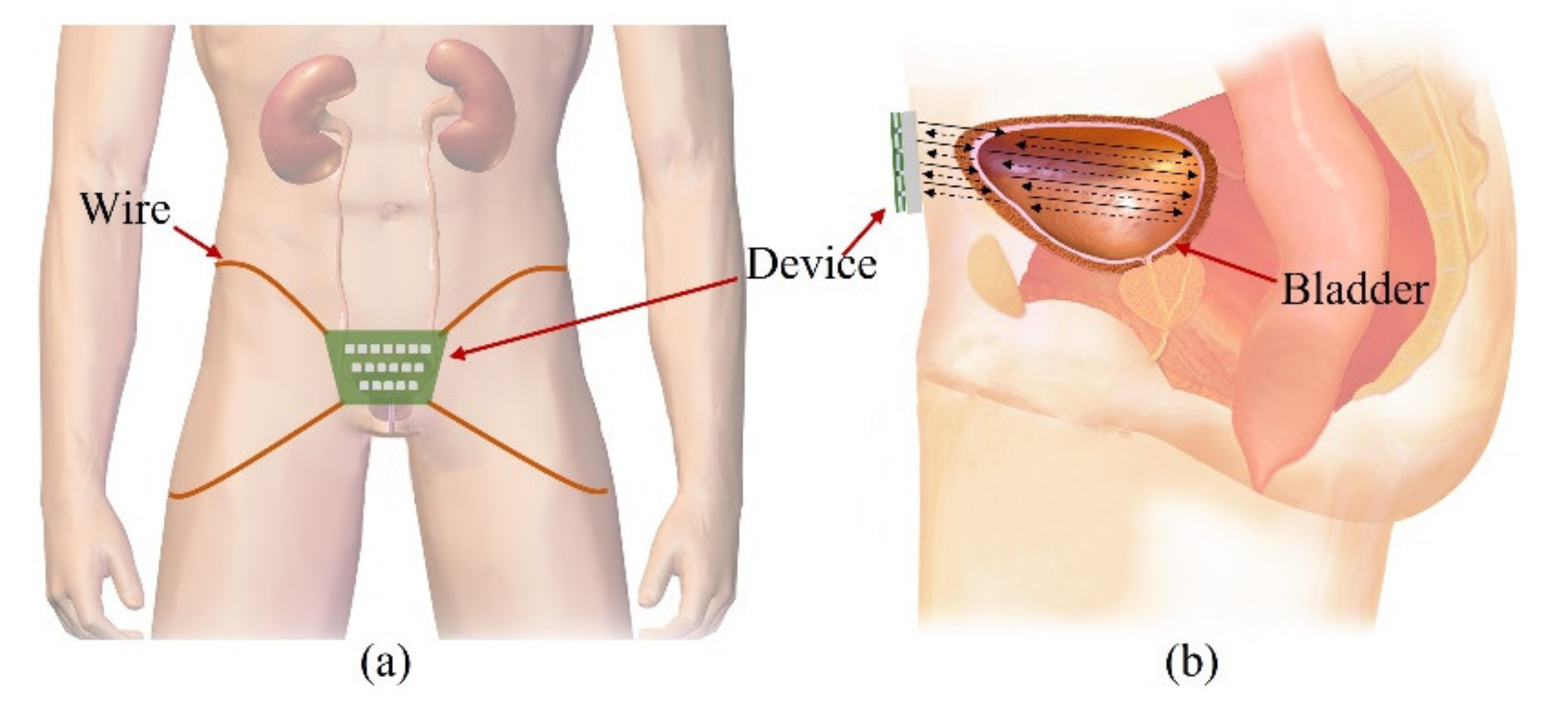 Sensors 21 05445 g001