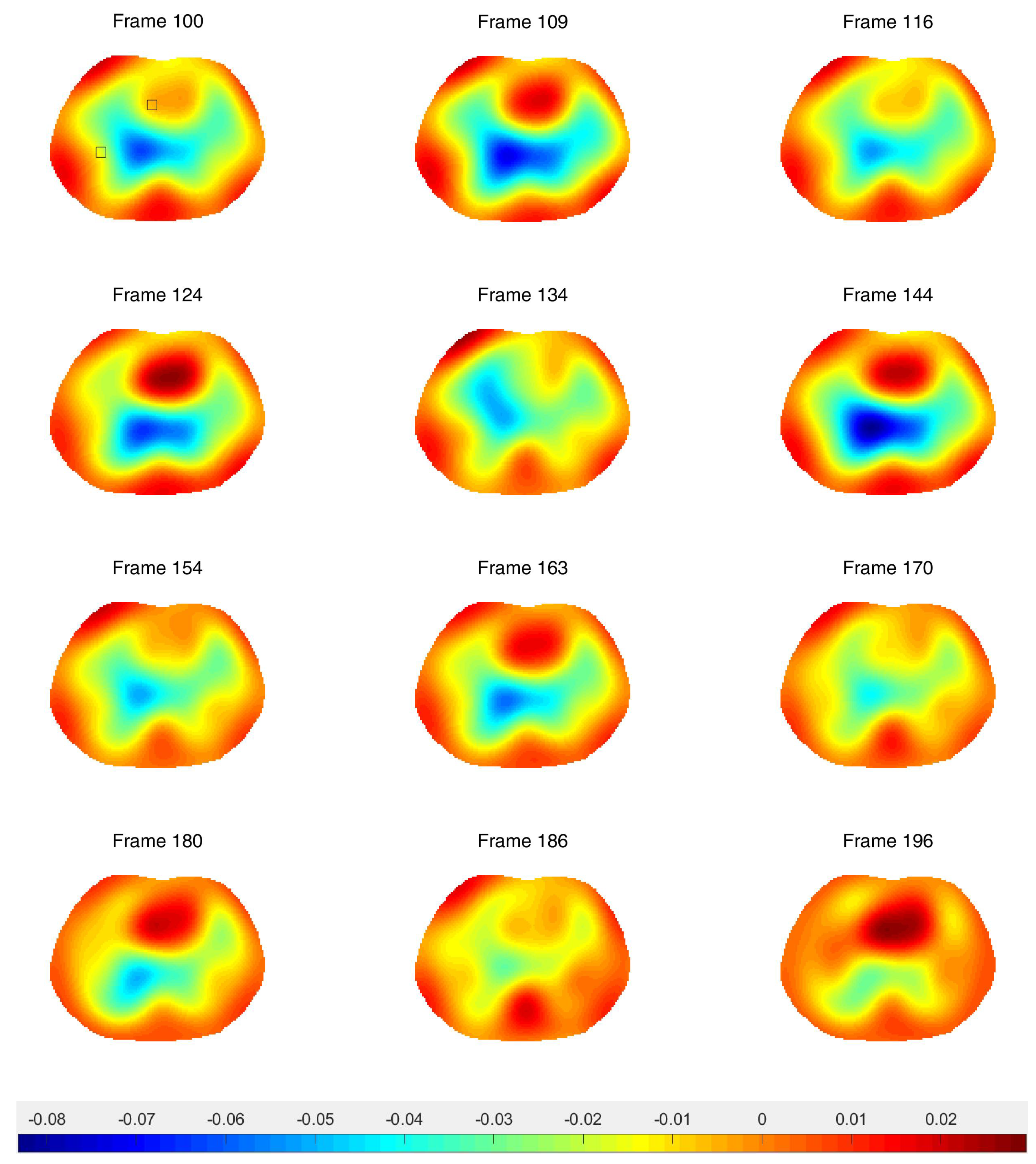Sensors 21 05635 g012