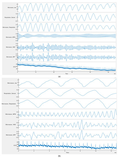 Sensors 21 05735 g009 550