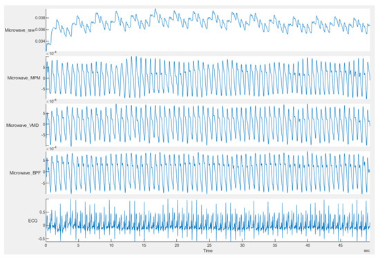 Sensors 21 05735 g012 550