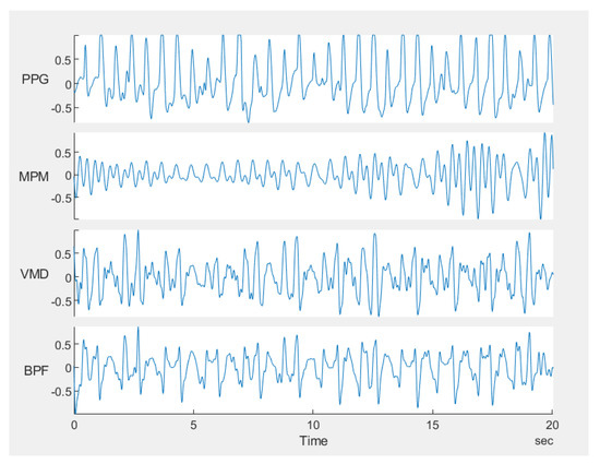 Sensors 21 05735 g016 550