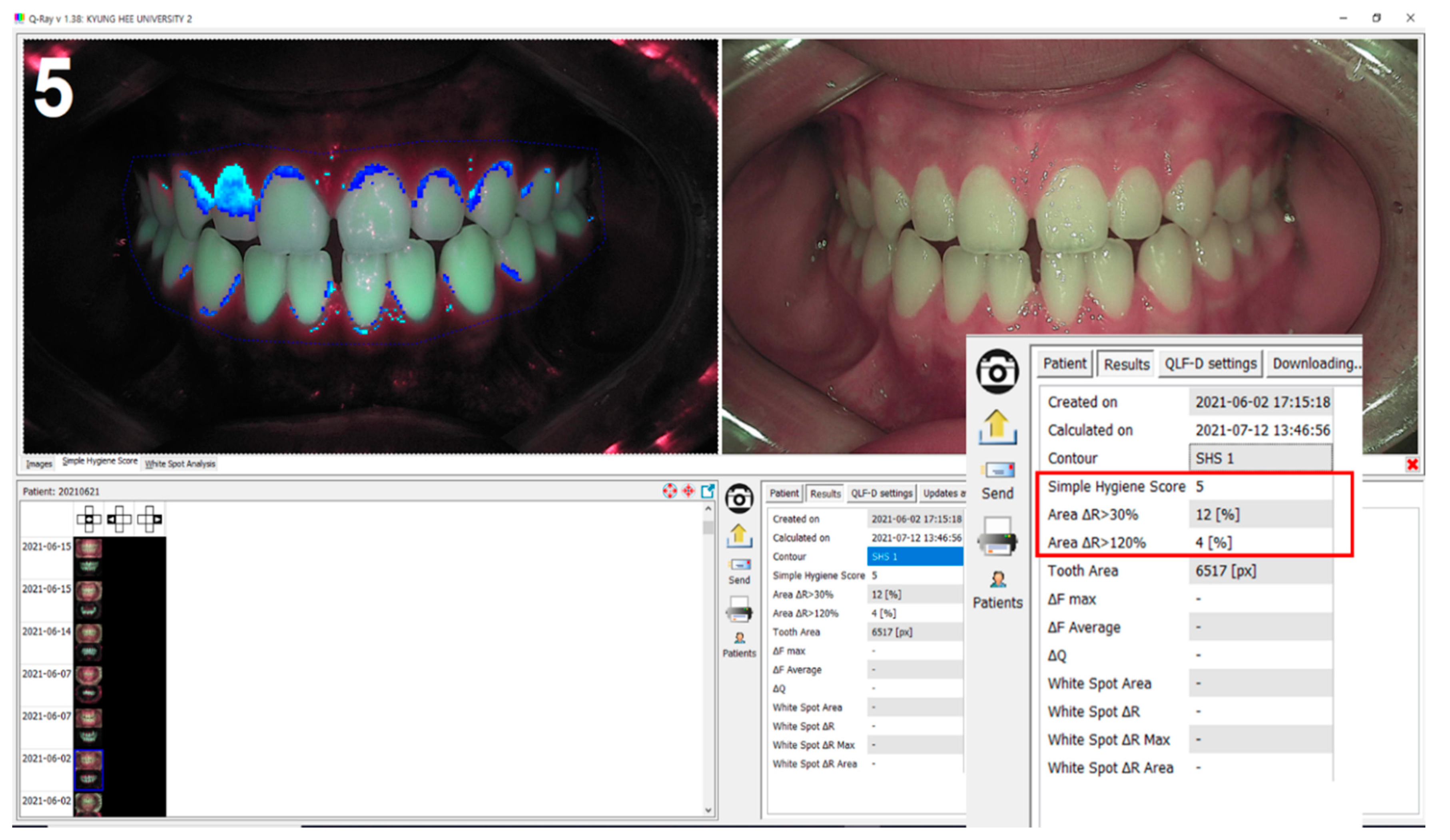Sensors 21 05774 g003