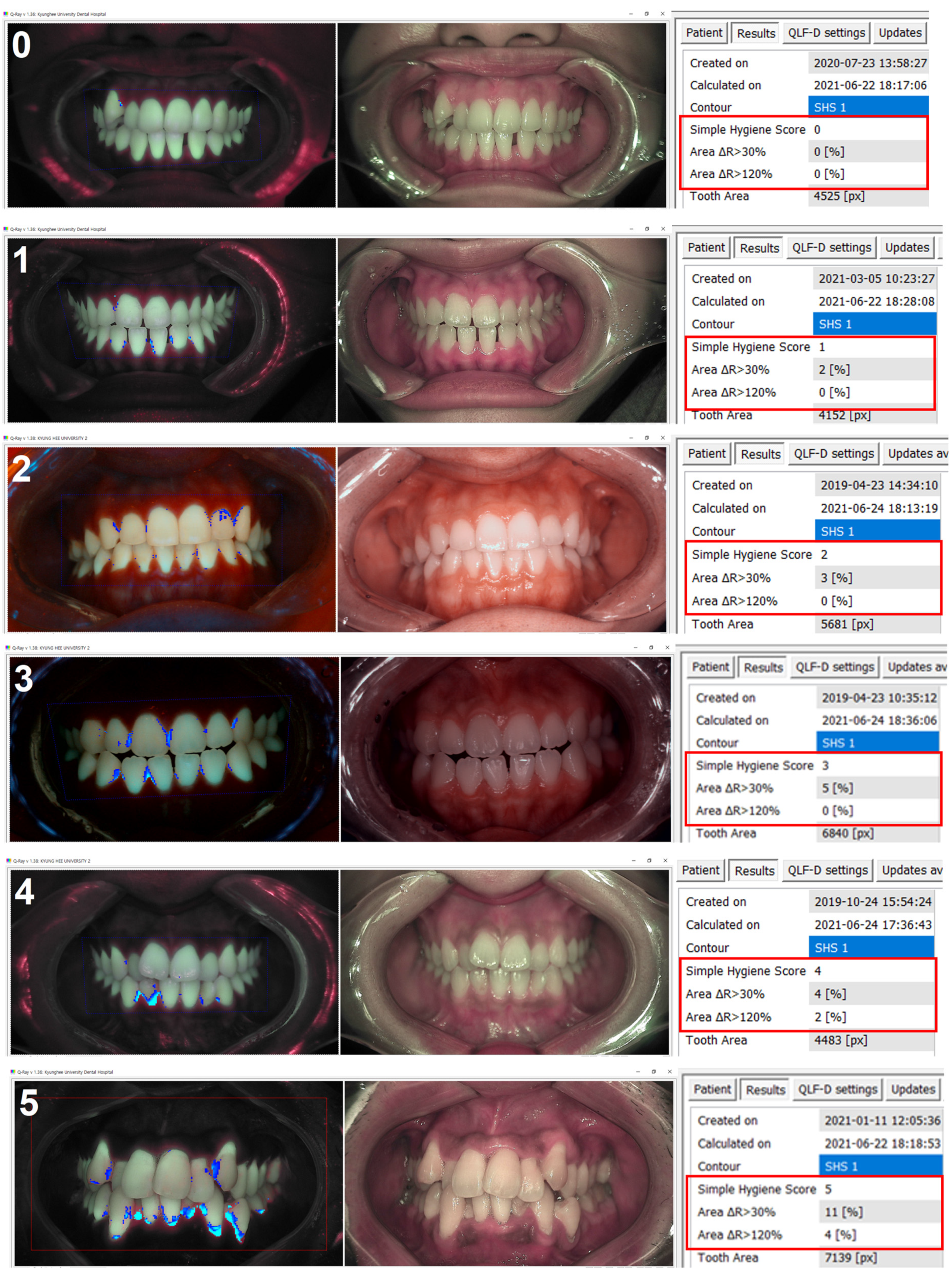 Sensors 21 05774 g004