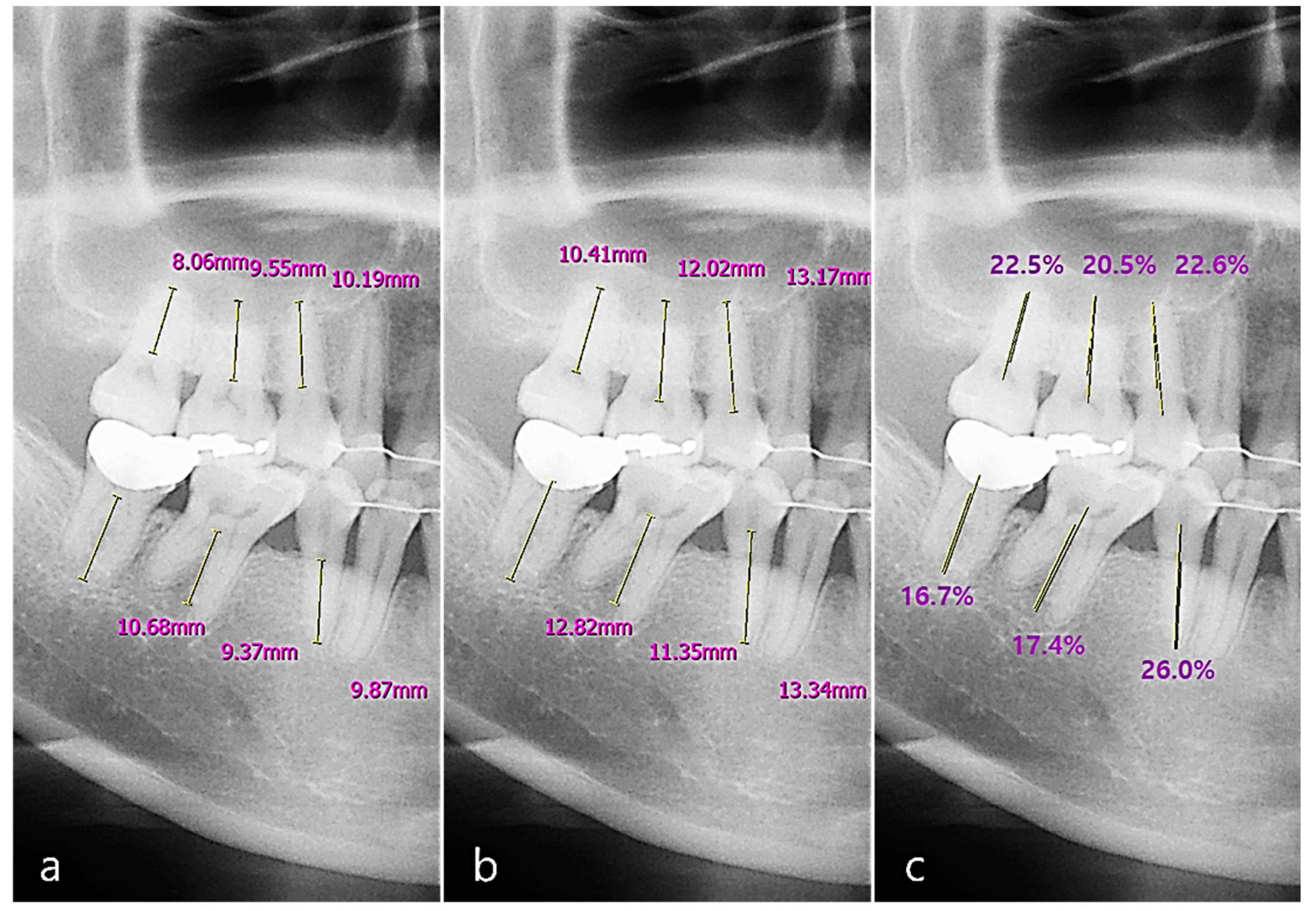 Sensors 21 05774 g005