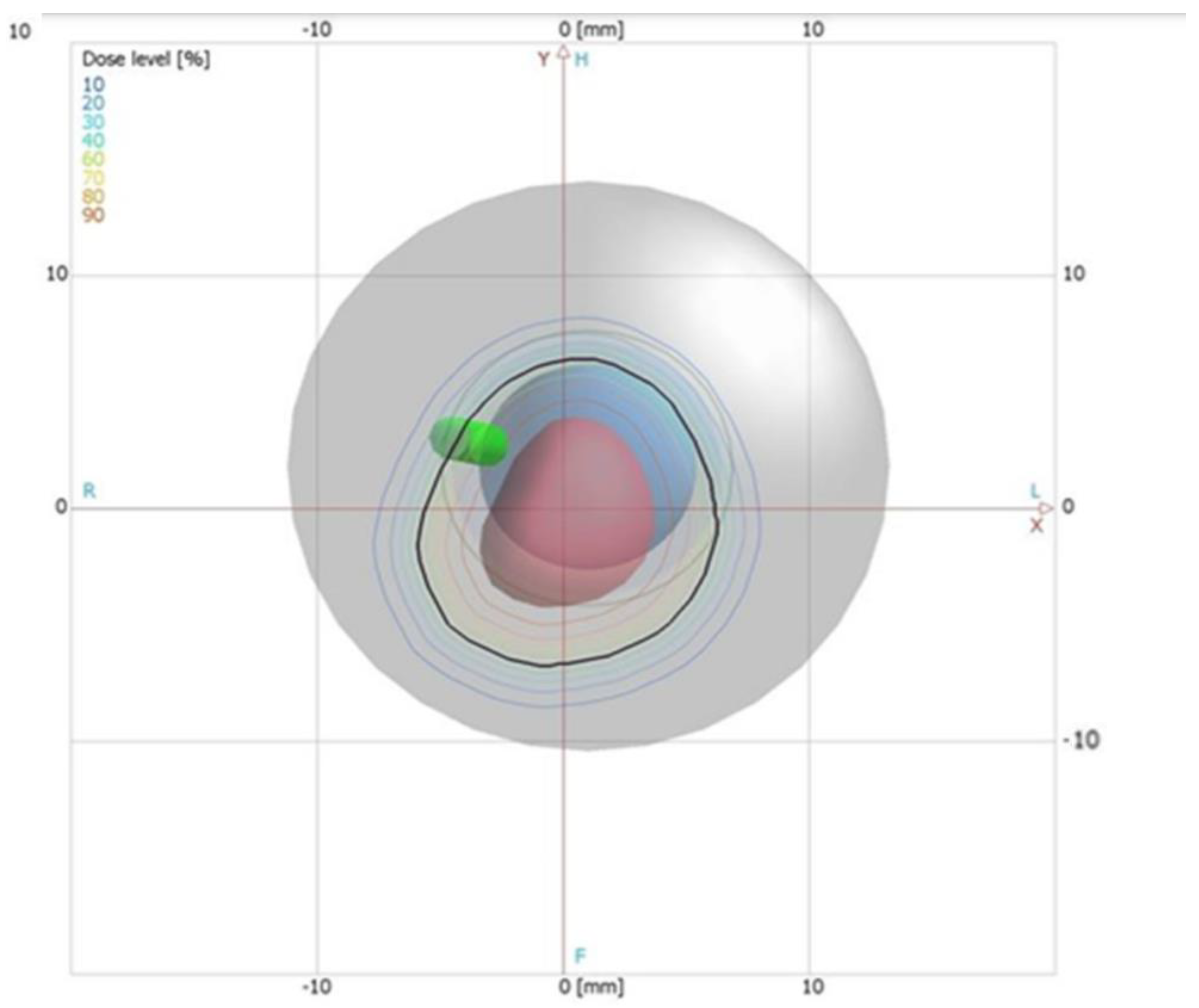 Sensors 21 06015 g002