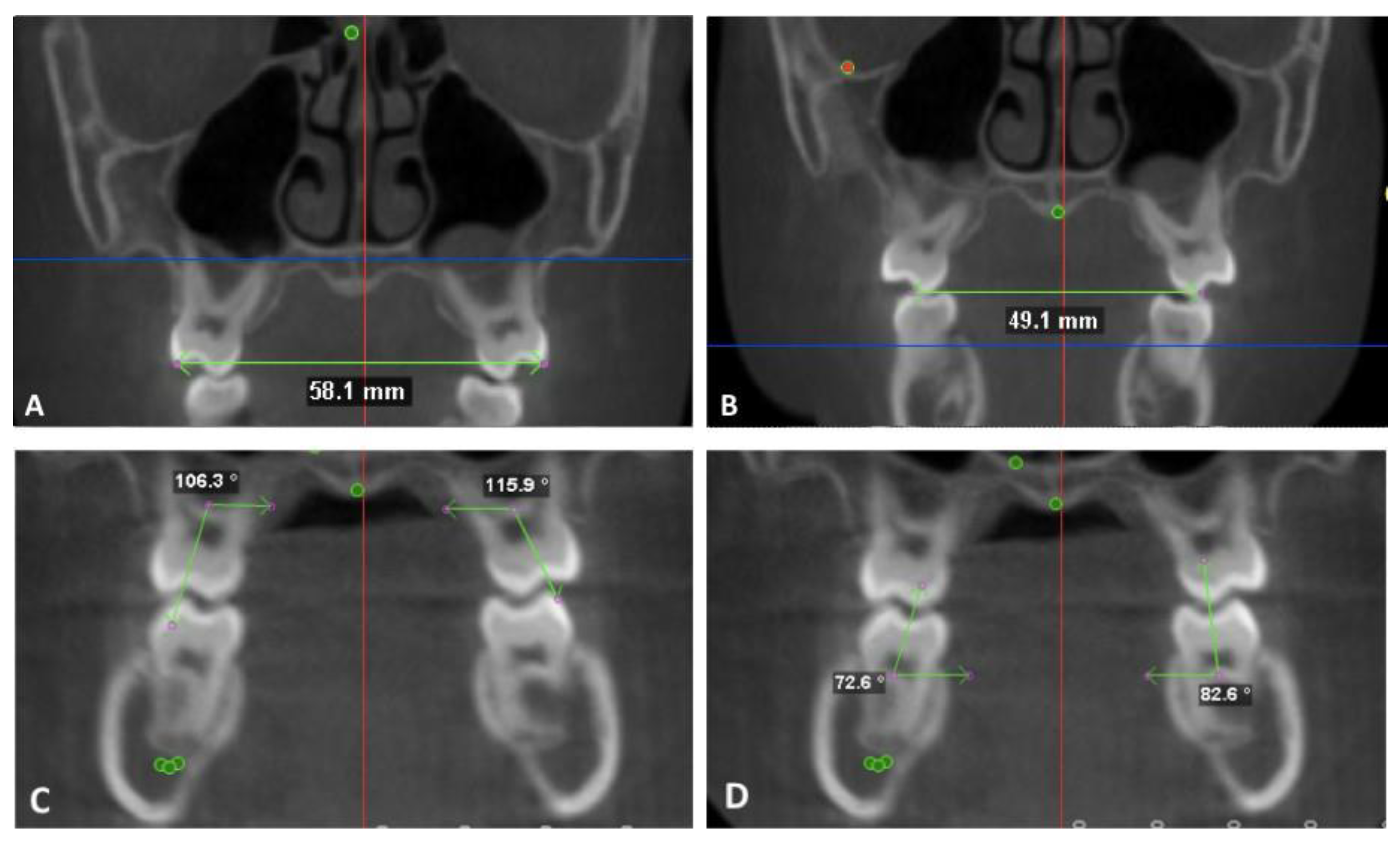 Sensors 21 06378 g004