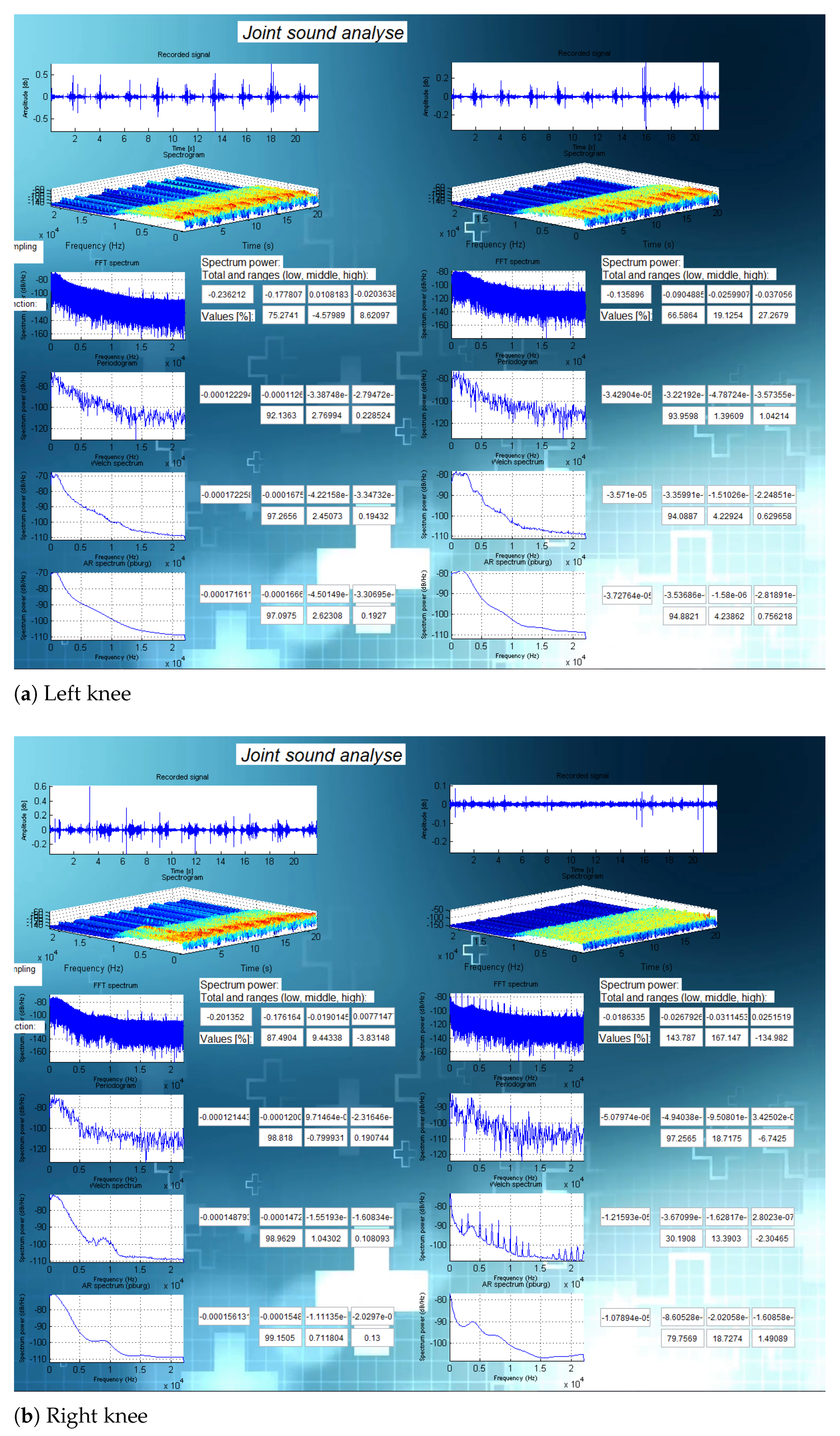 Sensors 21 06495 g010