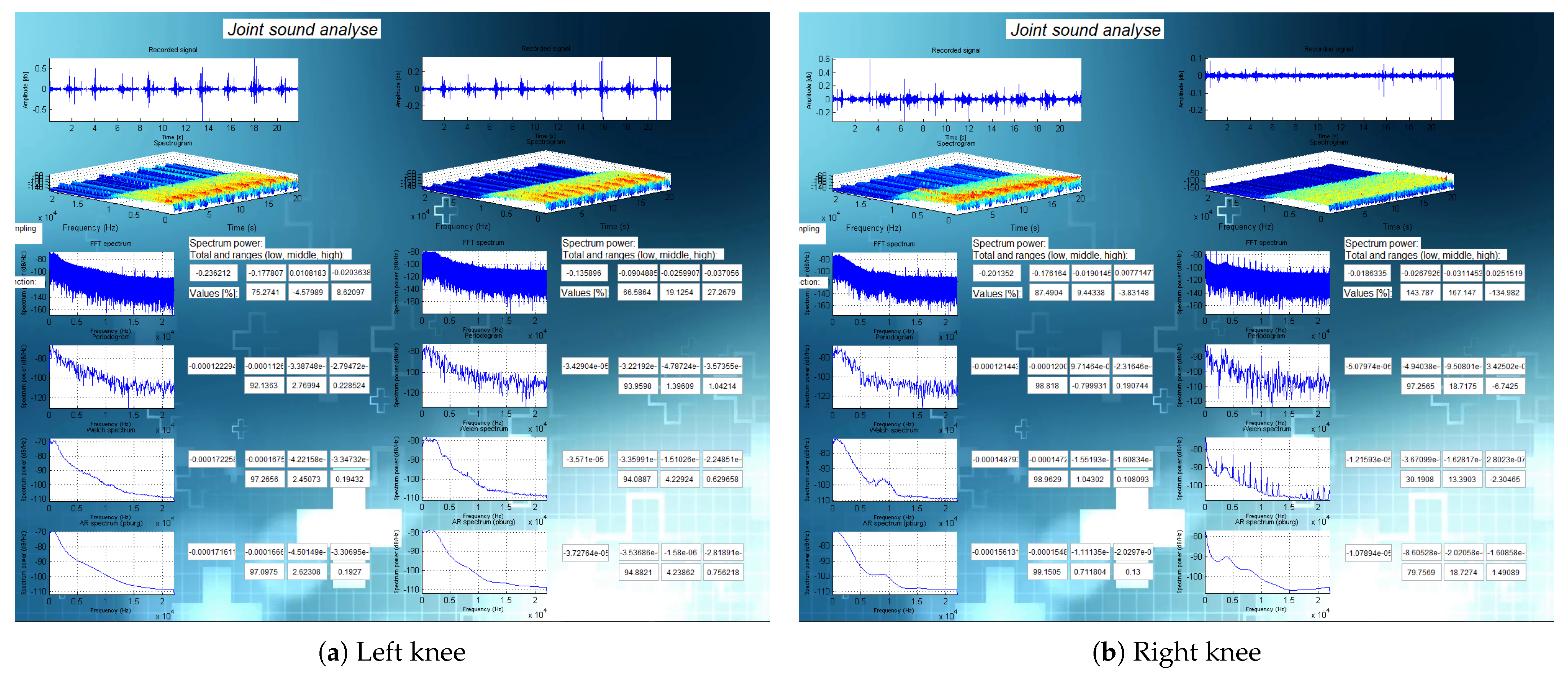 Sensors 21 06495 g0a14