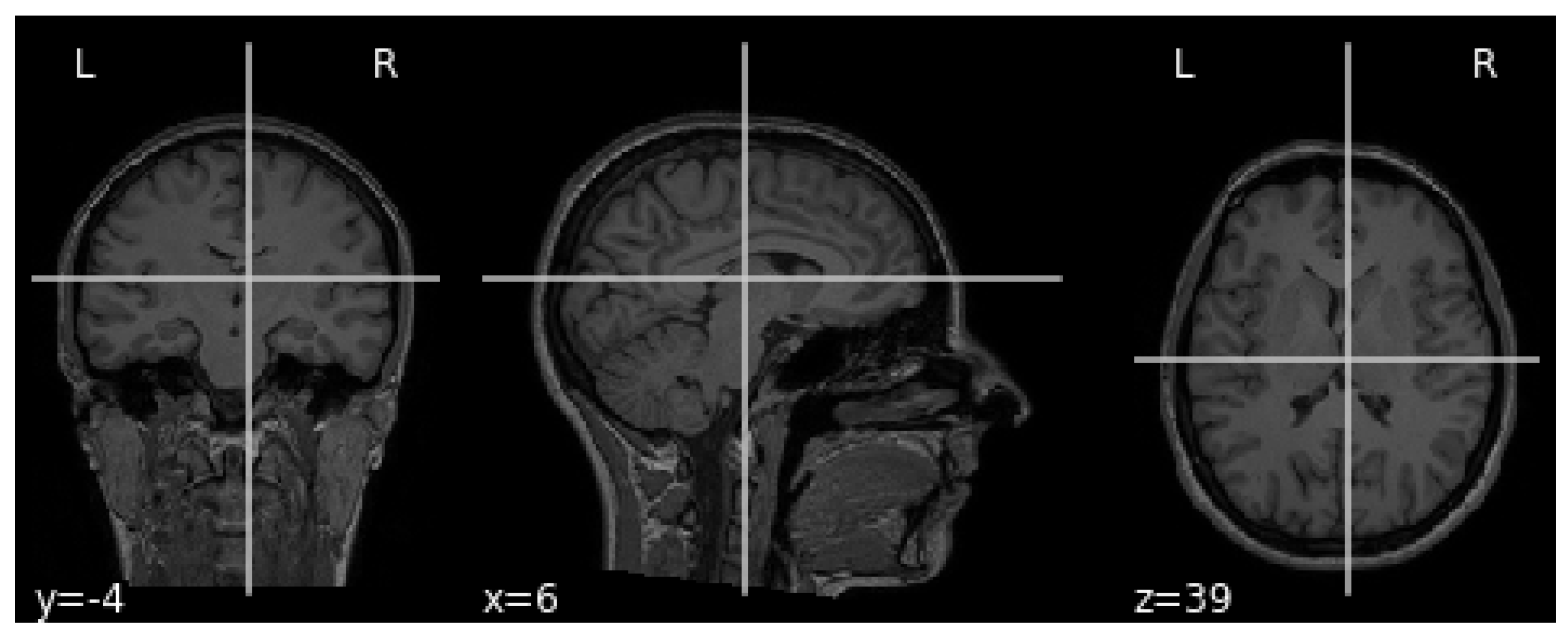 Sensors 21 06654 g003