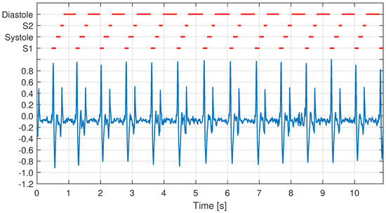 Sensors 21 06656 g007 550