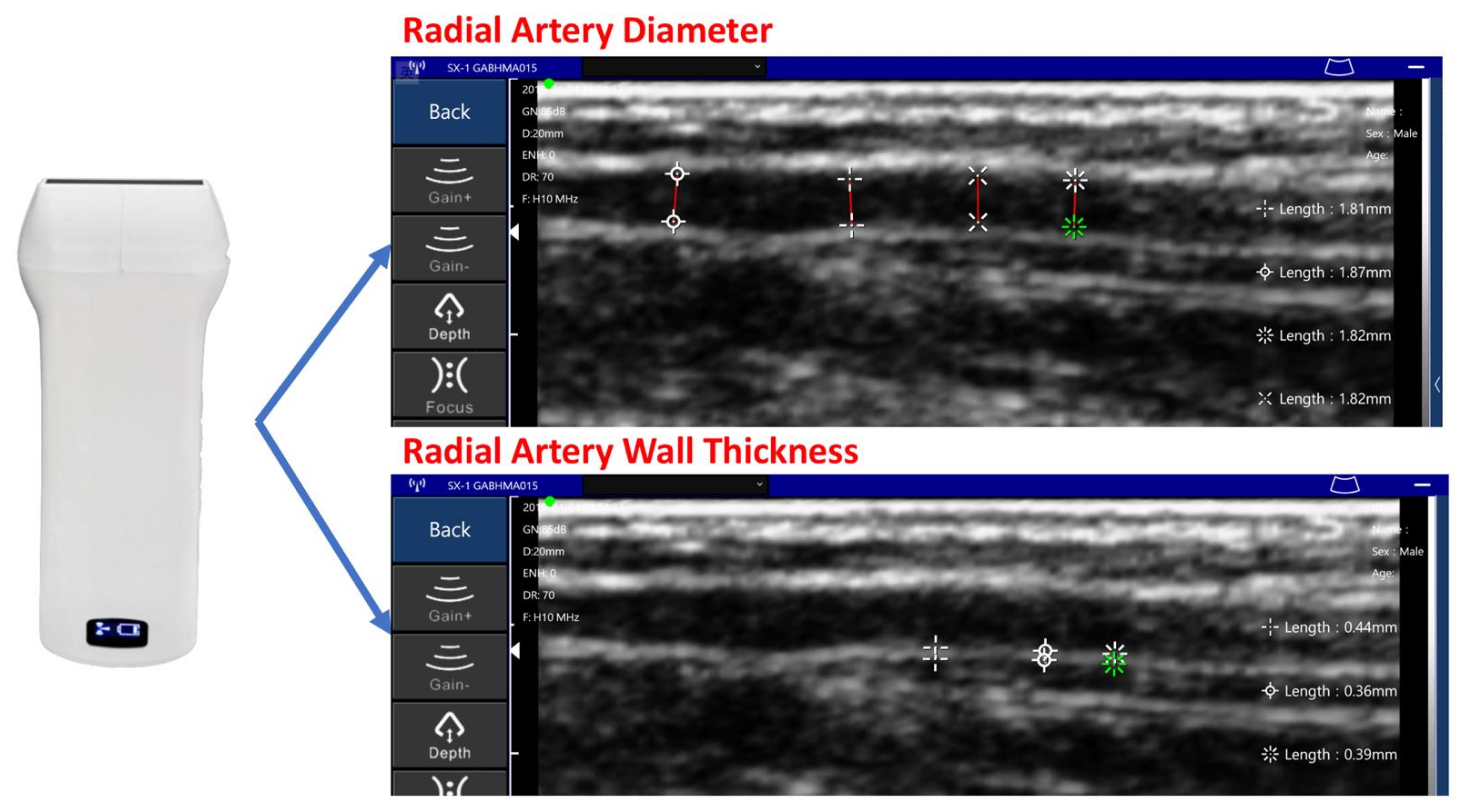 Sensors 21 06915 g011