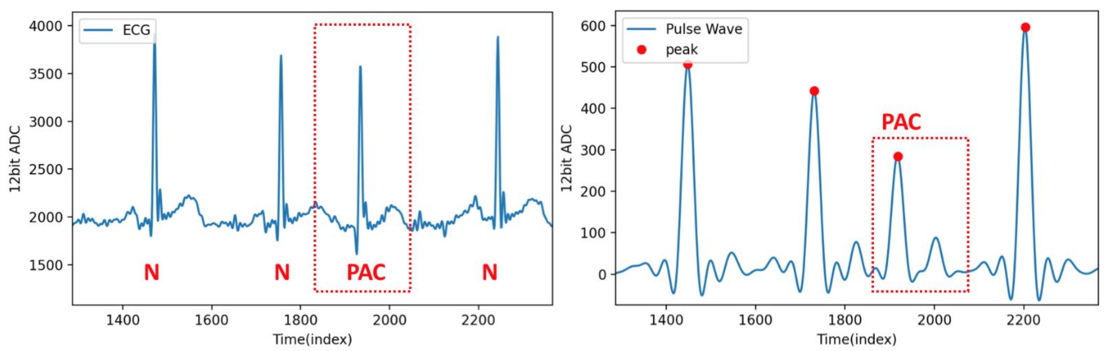 Sensors 21 06915 g014