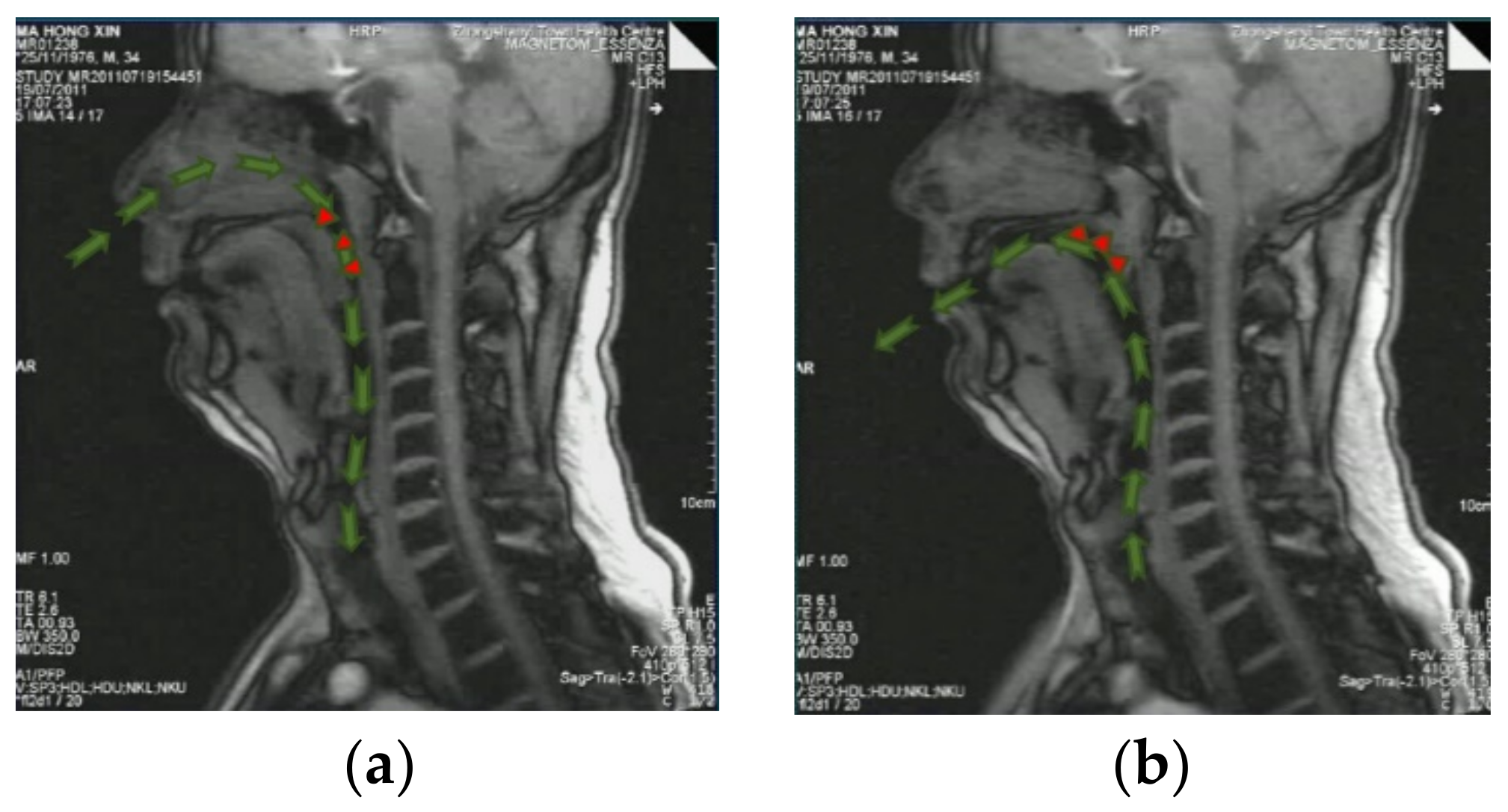 Sensors 21 07457 g006