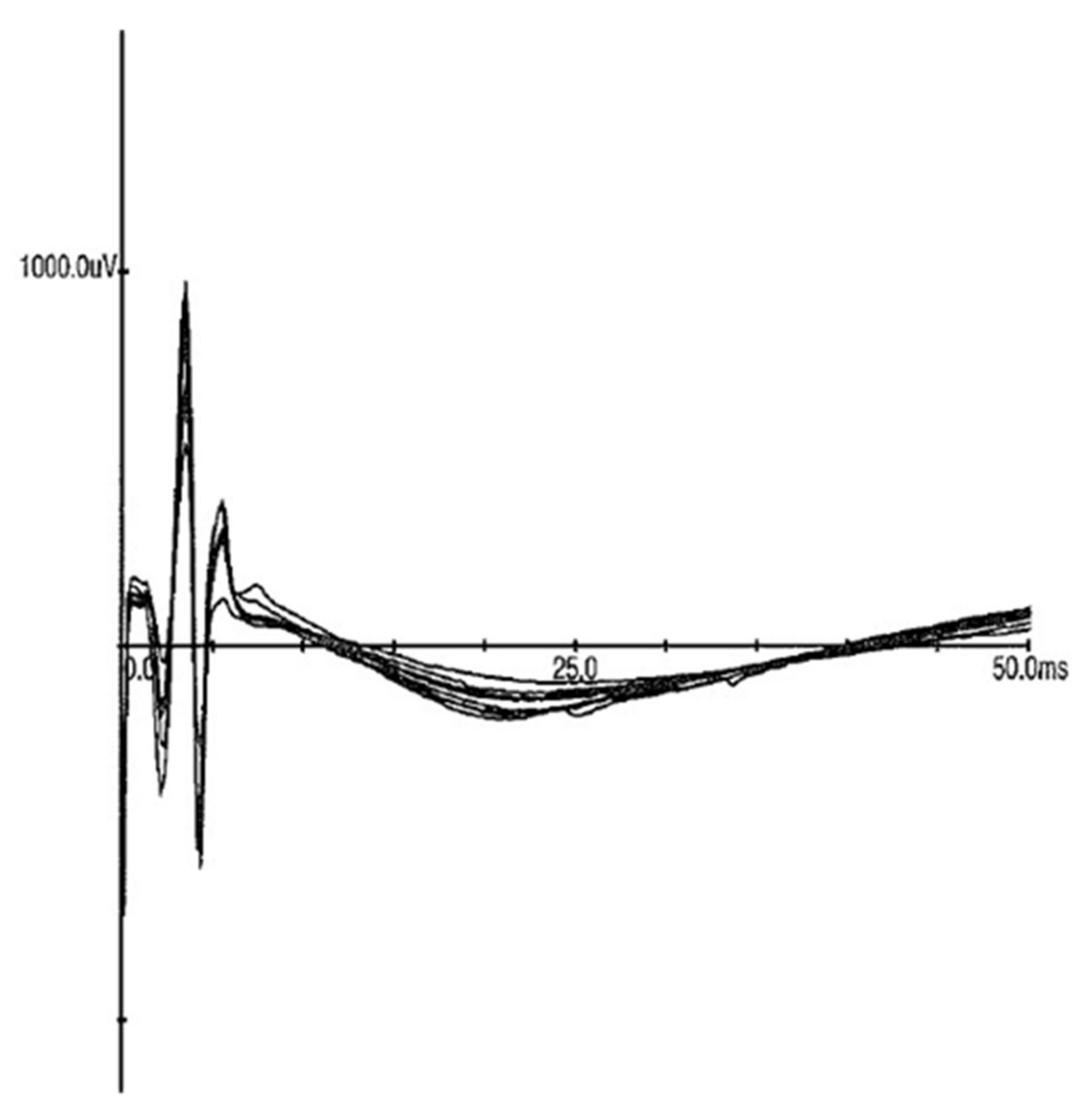 Sensors 21 07581 g006