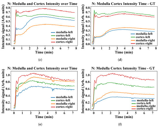 Sensors 21 07942 g0a1b 550