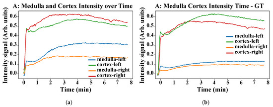 Sensors 21 07942 g0a2a 550