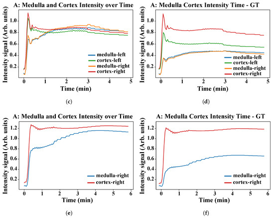 Sensors 21 07942 g0a2b 550