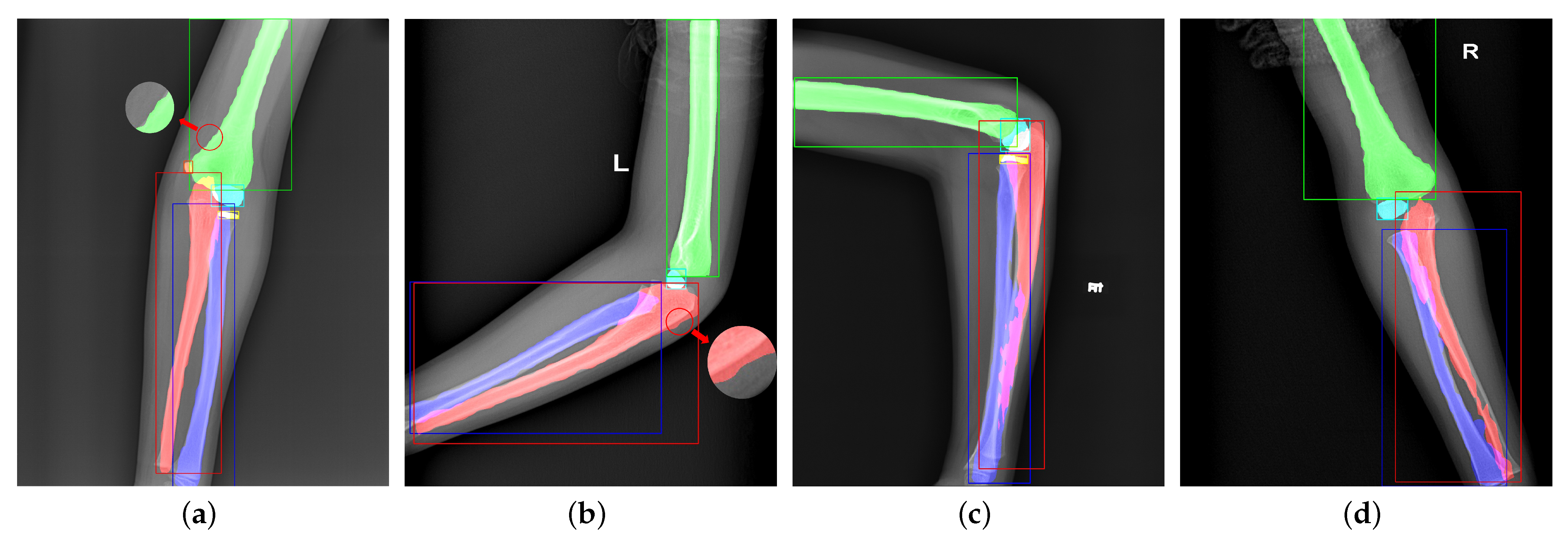 Sensors 21 07966 g006