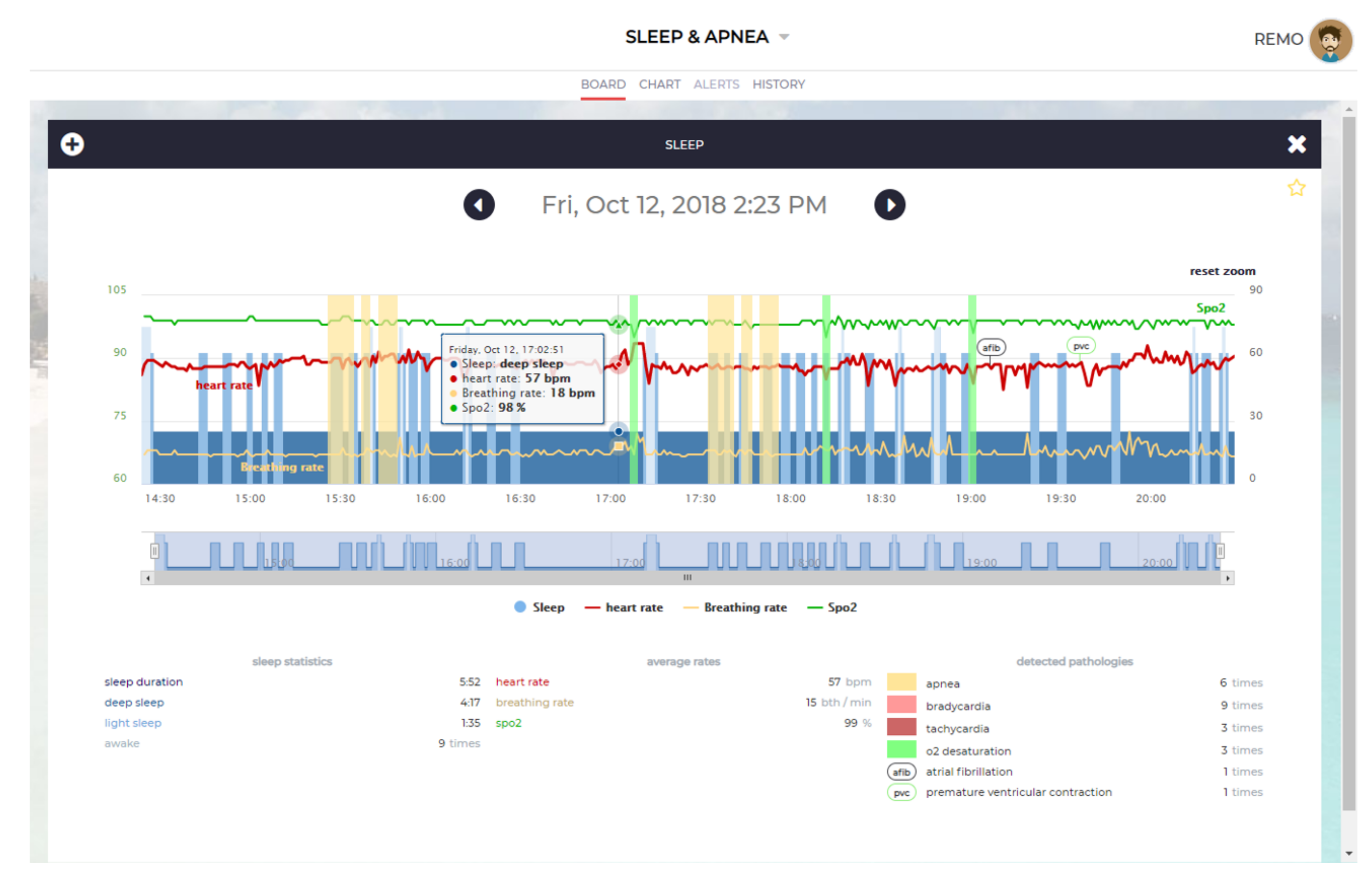 Sensors 21 07976 g006