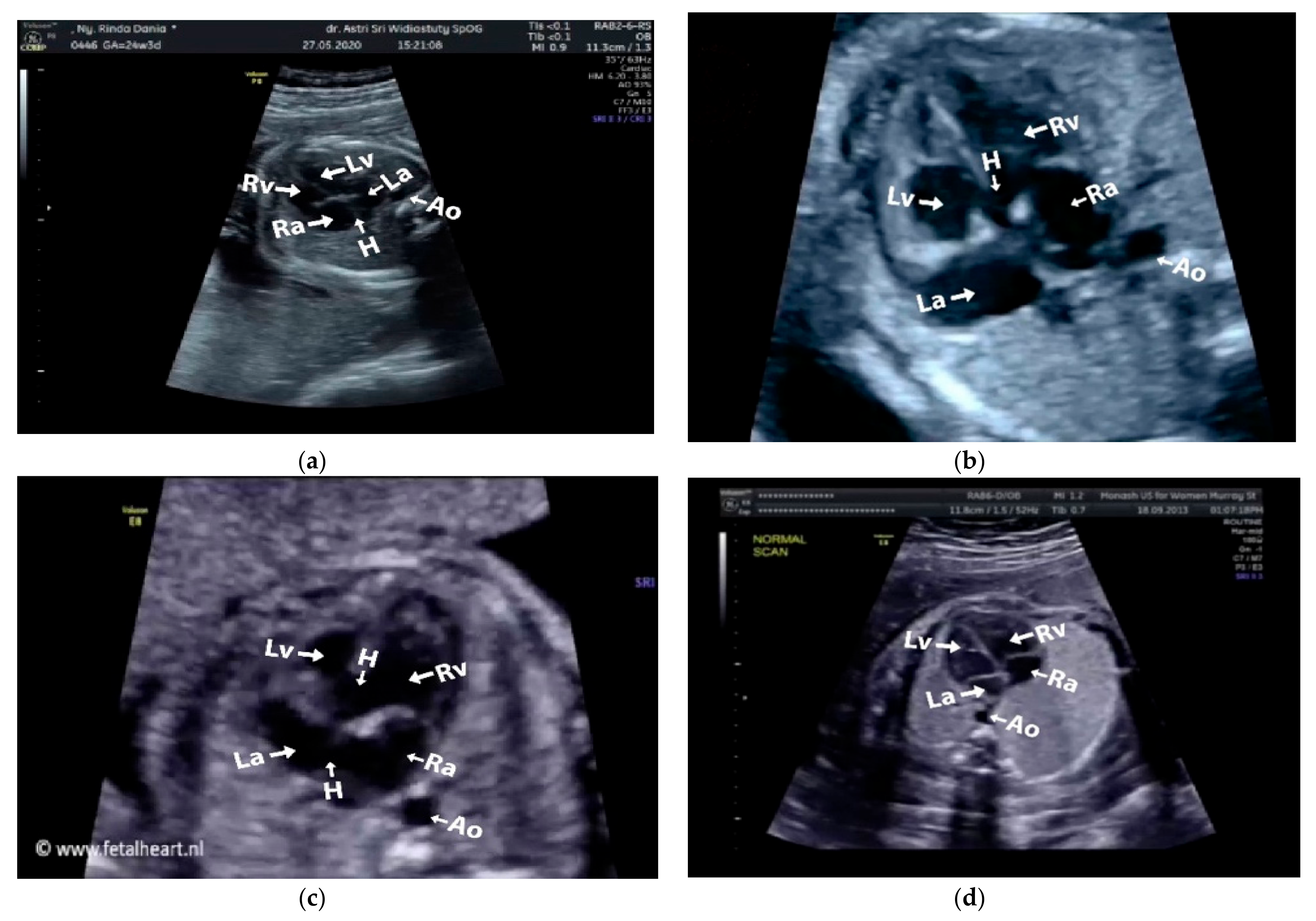 Sensors 21 08007 g003