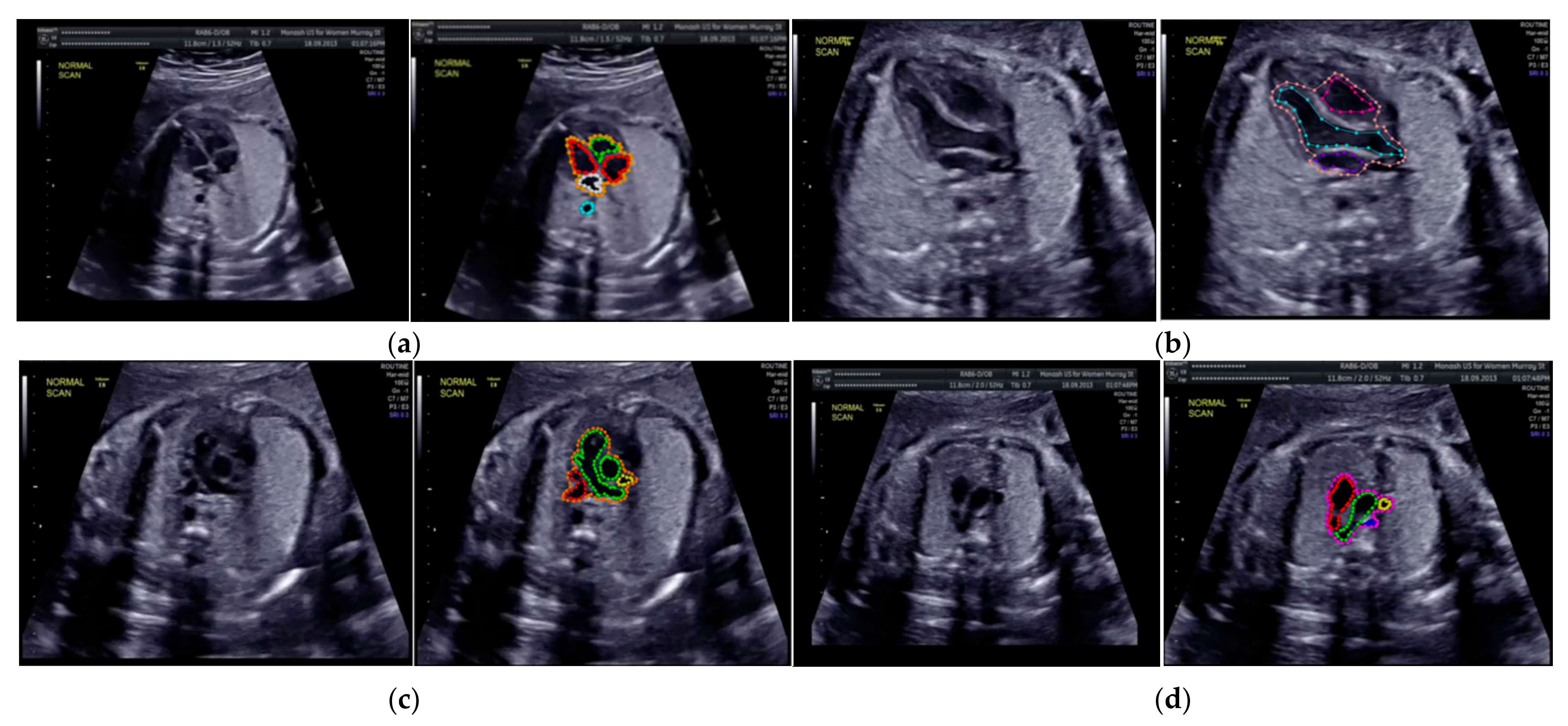 Sensors 21 08007 g004