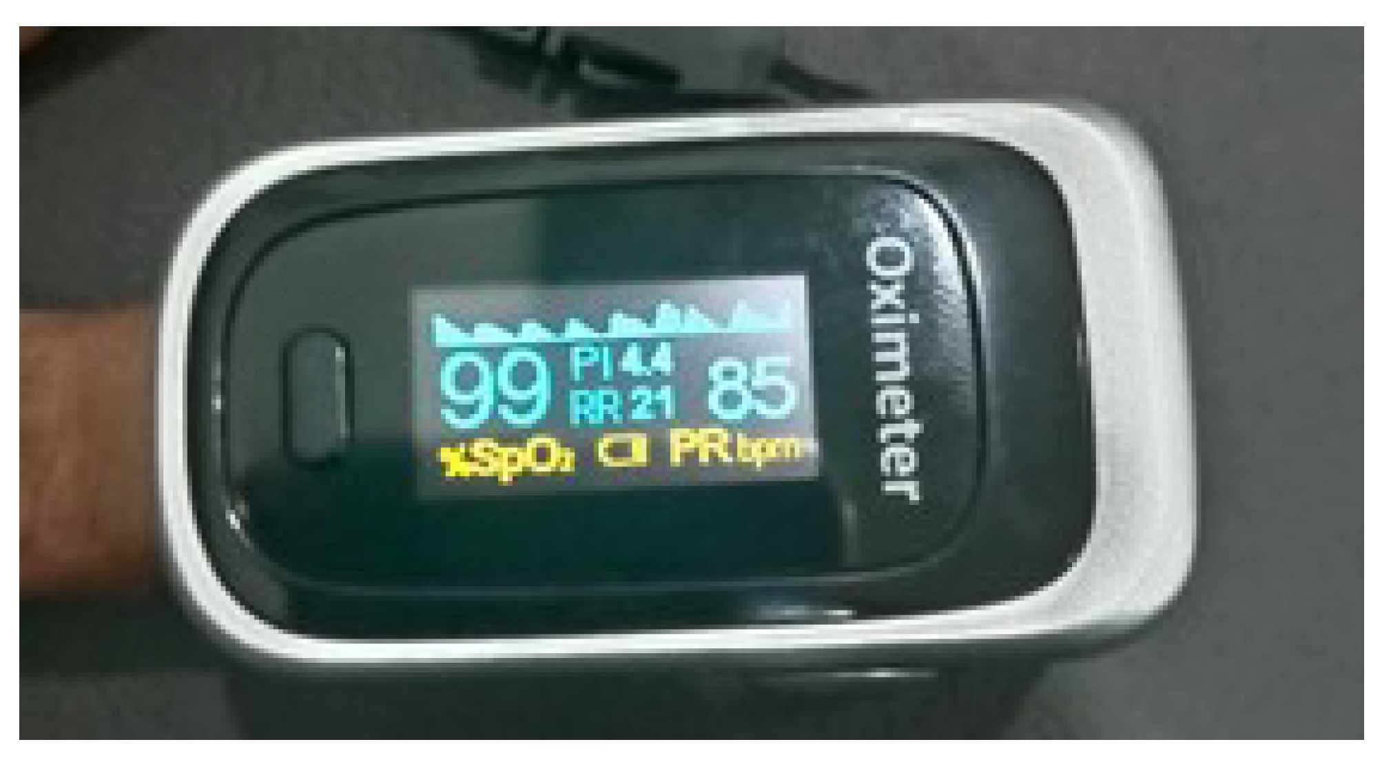 Sensors 21 08336 g011