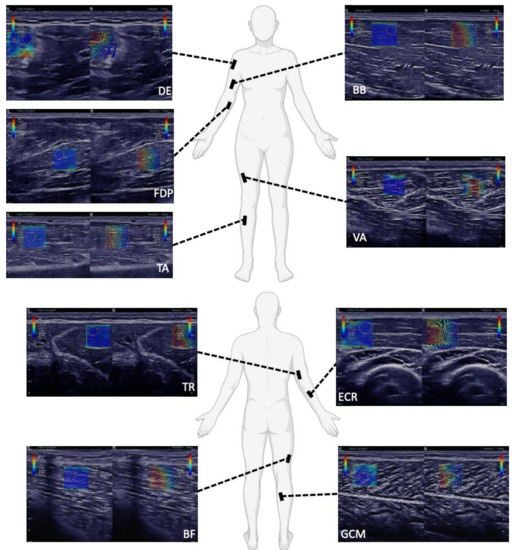 Sensors 21 08490 g0a1