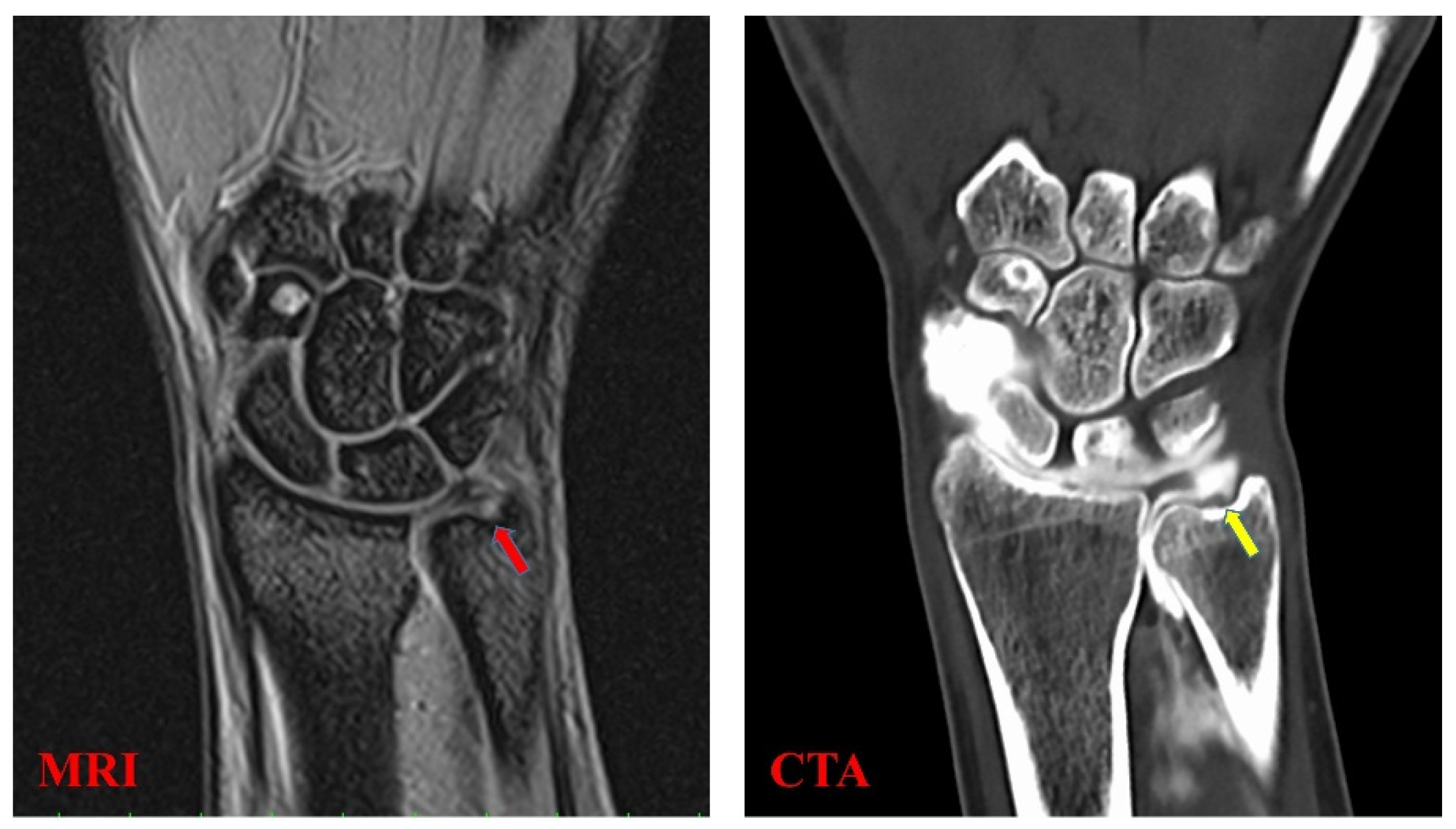 Sensors 22 00345 g002