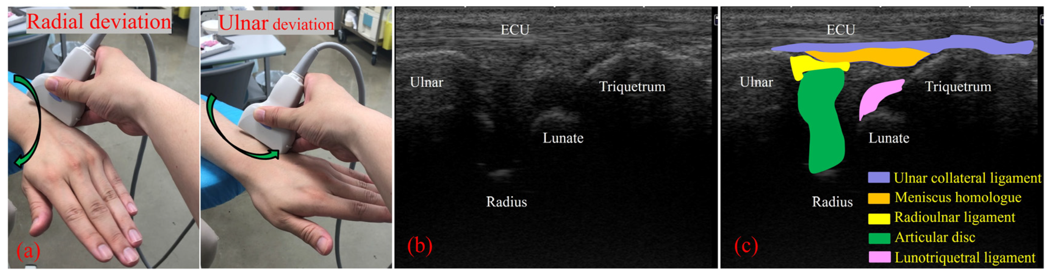 Sensors 22 00345 g003